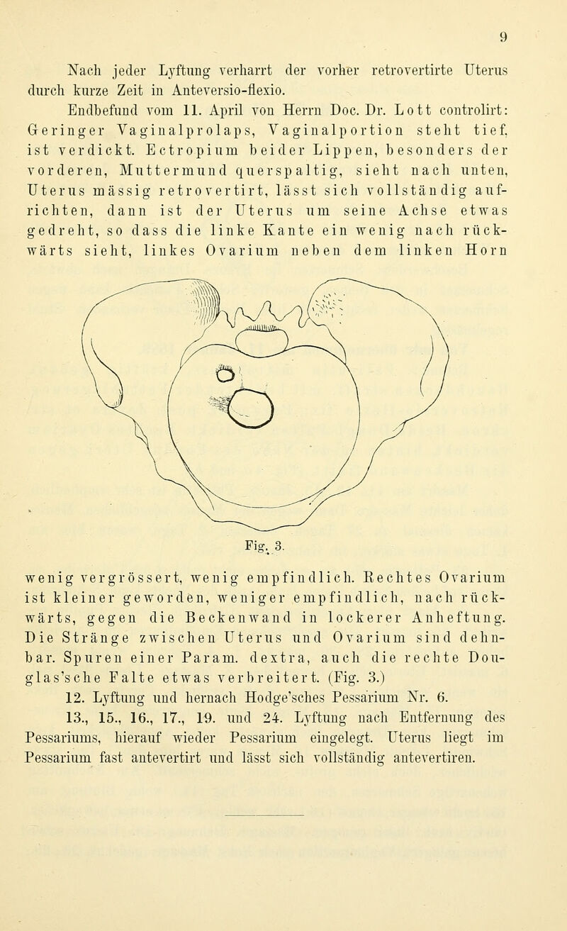 Nach jeder Lyftung verharrt der vorher retrovertirte Uterus durch kurze Zeit in Anteversio-flexio. Endbefund vorn 11. April von Herrn Doc. Dr. Lott controlirt: Geringer Vaginalprolaps, Vaginalportion steht tief, ist verdickt. Ectropium beider Lippen, besonders der vorderen, Muttermund querspaltig, sieht nach unten, Uterus massig retrovertirt, lässt sich vollständig auf- richten, dann ist der Uterus um seine Achse etwas gedreht, so dass die linke Kante ein wenig nach rück- wärts sieht, linkes Ovarium neben dem linken Hörn Fig. 3. wenig vergrössert, wenig empfindlich. Kechtes Ovarium ist kleiner geworden, weniger empfindlich, nach rück- wärts, gegen die Beckenwand in lockerer Anheftung. Die Stränge zwischen Uterus und Ovarium sind dehn- bar. Spuren einer Param. dextra, auch die rechte Dou- g las's che Falte etwas verbreitert. (Fig. 3.) 12. Lyftung und hernach Hodge'sches Pessärium Nr. 6. 13., 15., 16., 17., 19. und 24. Lyftung nach Entfernung des Pessariums, hierauf wieder Pessärium eingelegt. Uterus liegt im Pessärium fast antevertirt und lässt sich vollständig; antevertiren.