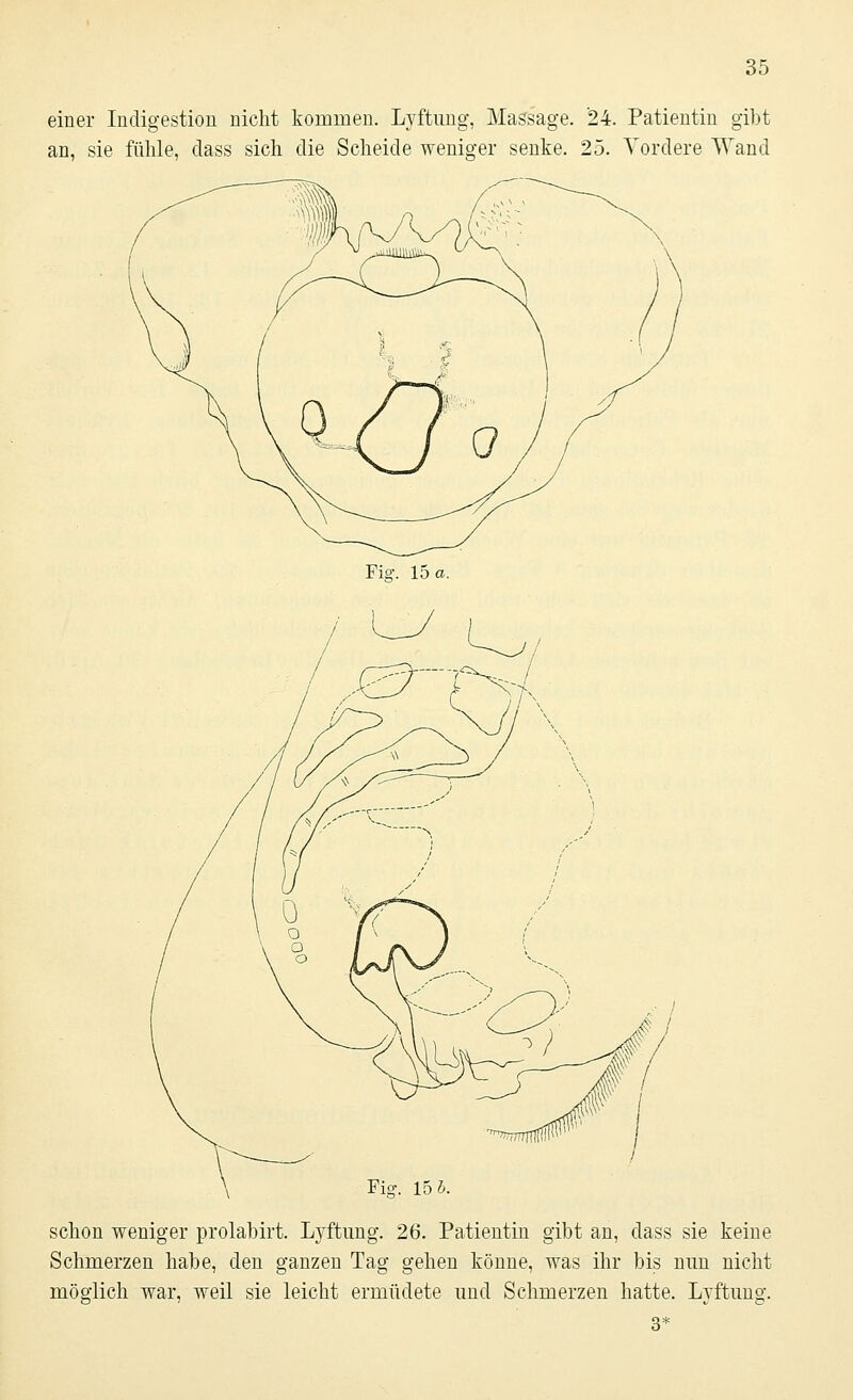 einer Indigestion nicht kommen. Lyftung, Massage. 24. Patientin gibt an, sie fühle, dass sich die Scheide weniger senke. 25. Vordere Wand Fi°\ 15 a. Fisr. 15 5 schon weniger prolabirt. Lyftung. 26. Patientin gibt an, dass sie keine Schmerzen habe, den ganzen Tag gehen könne, was ihr bis nun nicht möglich war, weil sie leicht ermüdete und Schmerzen hatte. Lyftung. 3*