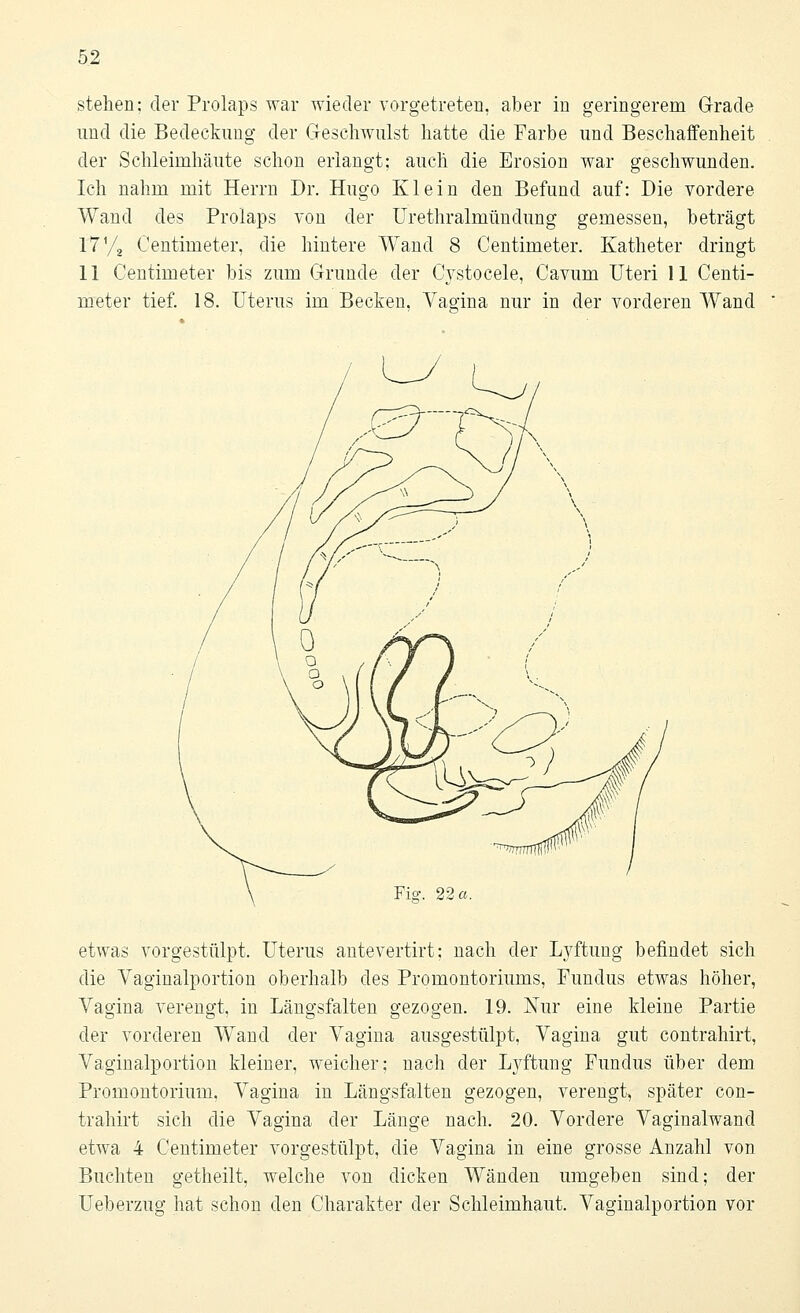 stehen; der Prolaps war wieder vorgetreten, aber in geringerem Grade und die Bedeckung der Geschwulst hatte die Farbe und Beschaffenheit der Schleimhäute schon erlangt; auch die Erosion war geschwunden. Ich nahm mit Herrn Dr. Hugo Klein den Befund auf: Die vordere Wand des Prolaps von der Urethralmündung gemessen, beträgt l7'/2 Centimeter, die hintere Wand 8 Centimeter. Katheter dringt 11 Centimeter bis zum Grunde der Cystocele, Cavum Uteri 11 Centi- meter tief. 18. Uterus im Becken, Vadna nur in der vorderen Wand Fio\ 22 a. etwas vorgestülpt. Uterus antevertirt; nach der Lyftung befindet sich die Vaginalportion oberhalb des Promontoriums, Fundus etwas höher, Vagina verengt, in Längsfalten gezogen. 19. Nur eine kleine Partie der vorderen Wand der Vagina ausgestülpt, Vagina gut contrahirt, Vaginalportion kleiner, weicher: nach der Lüftung Fundus über dem Promontorium, Vagina in Längsfalten gezogen, verengt, später con- trahirt sich die Vagina der Länge nach. 20. Vordere Vaginalwand etwa 4 Centimeter vorgestülpt, die Vagina in eine grosse Anzahl von Buchten getheilt, welche von dicken Wänden umgeben sind; der Ueberzug hat schon den Charakter der Schleimhaut. Vaginalportion vor