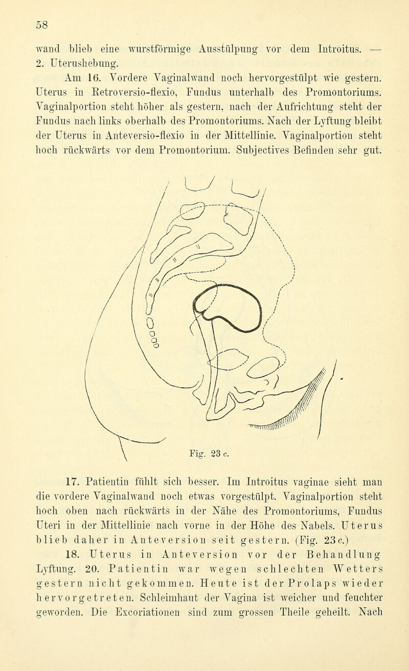 wand blieb eine wurstförmige Ausstülpung vor dem Introitus. — 2. Uterushebung. Am 16. Vordere Vaginalwand noch hervorgestülpt wie gestern. Uterus in Eetroversio-flexio, Fundus unterhalb des Promontoriums. Vaginalportion steht höher als gestern, nach der Aufrichtung steht der Fundus nach links oberhalb des Promontoriums. Nach der Lyftung bleibt der Uterus in Anteversio-flexio in der Mittellinie. Vaginalportion steht hoch rückwärts vor dem Promontorium. Subjectives Befinden sehr gut. Fis-. 23 c. 17. Patientin fühlt sich besser. Im Introitus vaginae sieht man die vordere Vaginalwand noch etwas vorgestülpt. Vaginalportion steht hoch oben nach rückwärts in der Nähe des Promontoriums, Fundus Uteri in der Mittellinie nach vorne in der Höhe des Nabels. Uterus blieb daher in Anteversion seit gestern. (Fig. 23c.) 18. Uterus in Ante Version vor der Behandlung Lyftung. 20. Patientin war wegen schlechten Wetters gestern nicht gekommen. Heute ist der Prolaps wieder hervorgetreten. Schleimhaut der Vagina ist weicher und feuchter geworden. Die Excoriationen sind zum grossen Theile geheilt. Nach