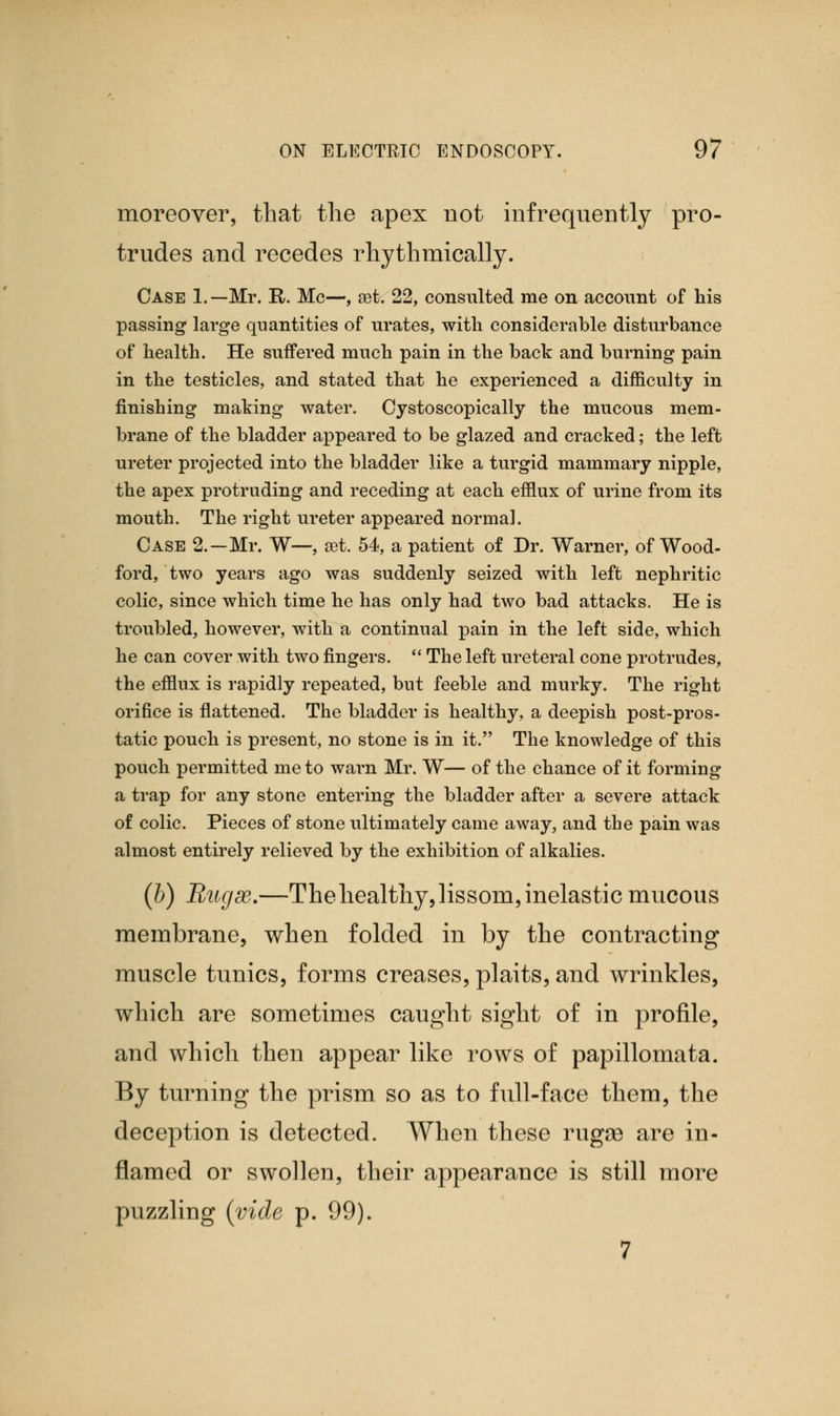 moreover, that the apex not infrequently pro- trudes and recedes rhythmically. Case 1.—Mr. R. Mc—, set. 22, consulted me on account of his passing large quantities of urates, with considerable disturbance of health. He suffered much pain in the back and burning pain in the testicles, and stated that he experienced a difficulty in finishing making water. Cystoscopically the mucous mem- brane of the bladder appeared to be glazed and cracked; the left ureter projected into the bladder like a turgid mammary nipple, the apex protruding and receding at each efflux of urine from its mouth. The right ureter appeared normal. Case 2.—Mr. W—, aet. 54, a patient of Dr. Warner, of Wood- ford, two years ago was suddenly seized with left nephritic colic, since which time he has only had two bad attacks. He is troubled, however, with a continual pain in the left side, which he can cover with two fingers. The left ureteral cone protrudes, the efflux is rapidly repeated, but feeble and murky. The right orifice is flattened. The bladder is healthy, a deepish post-pros- tatic pouch is present, no stone is in it. The knowledge of this pouch permitted me to warn Mr. W— of the chance of it forming a trap for any stone entering the bladder after a severe attack of colic. Pieces of stone ultimately came away, and the pain was almost entirely relieved by the exhibition of alkalies. (b) Rugae.—The healthy, lissom, inelastic mucous membrane, when folded in by the contracting muscle tunics, forms creases, plaits, and wrinkles, which are sometimes caught sight of in profile, and which then appear like rows of papillomata. By turning the prism so as to full-face them, the deception is detected. When these rugae are in- flamed or swollen, their appearance is still more puzzling {vide p. 99).