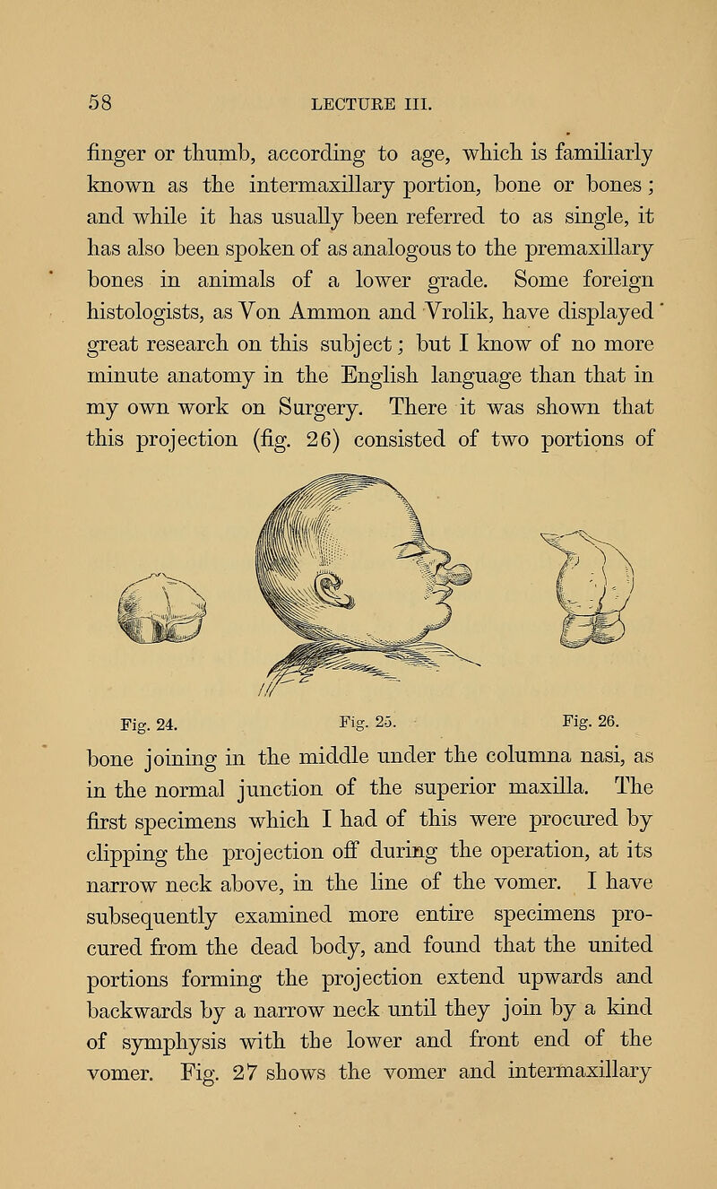 finger or thumb, according to age, which is familiarly known as the intermaxillary portion, bone or bones; and while it has usually been referred to as single, it has also been spoken of as analogous to the premaxillary bones in animals of a lower grade. Some foreign histologists, as Von Ammon and Vrolik, have displayed' great research on this subject; but I know of no more minute anatomy in the English language than that in my own work on Surgery. There it was shown that this projection (fig. 26) consisted of two portions of Fig. 24. Eig. 25. - Fig. 26. bone joining in the middle under the columna nasi, as in the normal junction of the superior maxilla. The first specimens which I had of this were procured by clipping the projection off during the operation, at its narrow neck above, in the line of the vomer. I have subsequently examined more entire specimens pro- cured from the dead body, and found that the united portions forming the projection extend upwards and backwards by a narrow neck until they join by a kind of symphysis with the lower and front end of the vomer. Fig. 27 shows the vomer and intermaxillary