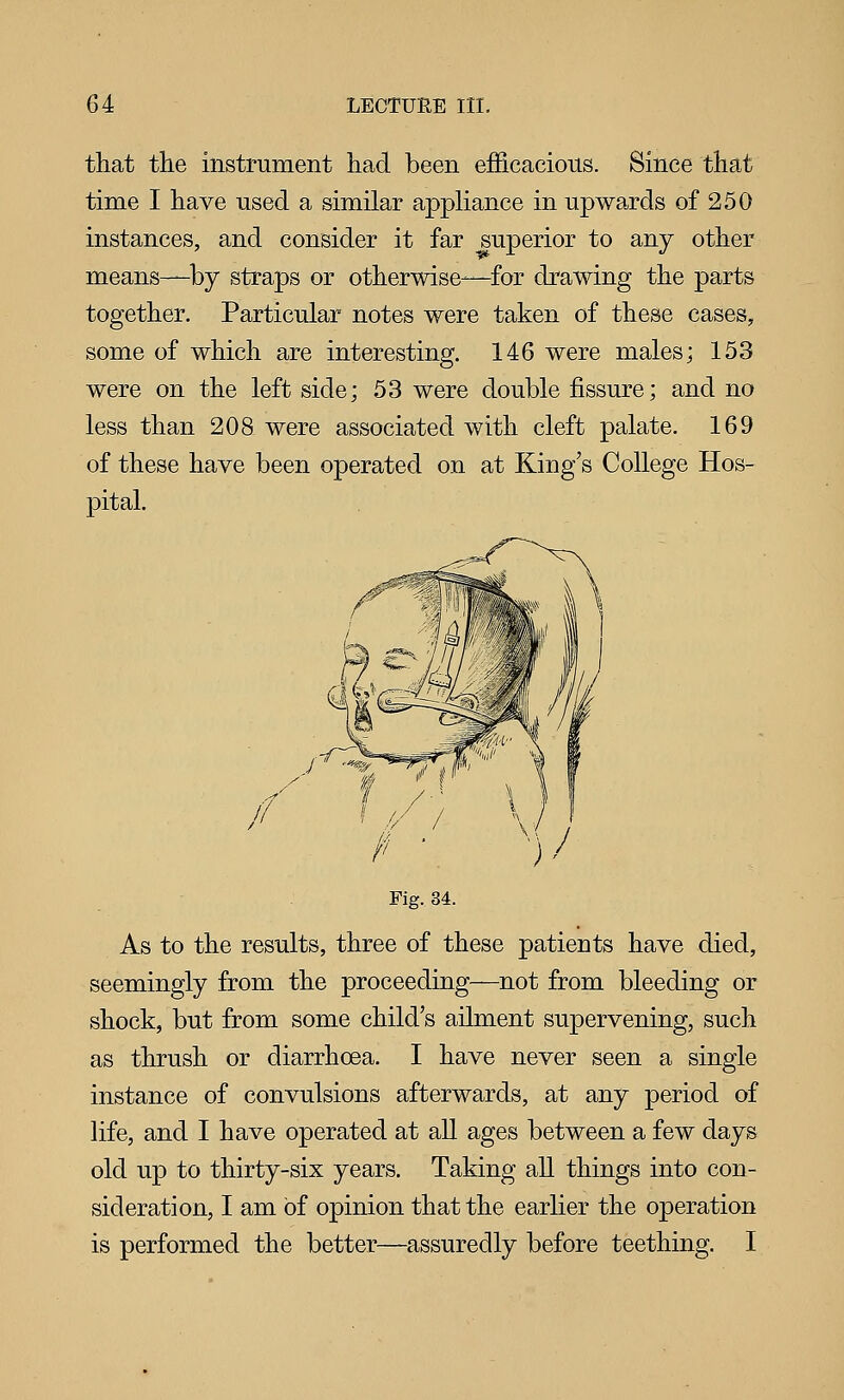 that the instrument had been efficacious. Since that time I have used a similar appHance in upwards of 250 instances, and consider it far ^superior to any other means—by straps or otherwise—for drawing the parts together. Particular notes were taken of these cases, some of which are interesting. 146 were males; 153 were on the left side; 53 were double fissure; and no less than 208 were associated with cleft palate. 169 of these have been operated on at King's College Hos- pital. Fig. 34. As to the results, three of these patients have died, seemingly from the proceeding—not from bleeding or shock, but from some child's ailment supervening, such as thrush or diarrhoea. I have never seen a single instance of convulsions afterwards, at any period of life, and I have operated at all ages between a few days old up to thirty-six years. Taking all things into con- sideration, I am of opinion that the earlier the operation is performed the better—assuredly before teething. I