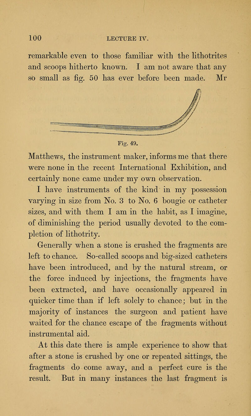 remarkable even to those familiar with the lithotrites and scoops hitherto known. I am not aware that any St) small as fig. 50 has ever before been made. Mr Fig. 49. Matthews, the instrument maker, informs me that there were none in the recent International Exhibition, and certainly none came under my own observation. I have instruments of the kind in my possession varying in size from No. 3 to No. 6 bougie or catheter sizes, and with them I am in the habit, as I imagine, of diminishing the period usually devoted to the com- pletion of lithotrity. Generally when a stone is crushed the fragments are left to chance. So-called scoops and big-sized catheters have been introduced, and by the natural stream, or the force induced by injections, the fragments have been extracted, and have occasionally appeared in quicker time than if left solely to chance; but in the majority of instances the surgeon and patient have waited for the chance escape of the fragments without instrumental aid. At this date there is ample experience to show that after a stone is crushed by one or repeated sittings, the fragments do come away, and a perfect cure is the result. But in many instances the last fragment is