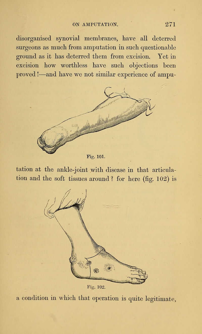 disorganised synovial membranes, have all deterred surgeons as much from amputation in such questionable ground as it has deterred them from excision. Yet in excision how worthless have such objections been proved!—and have we not similar experience of ampu- Fig. 101. tation at the ankle-joint with disease in that articula- tion and the soft tissues around? for here (fig. 102) is Fi«. 102. a condition in which that operation is quite legitimate,