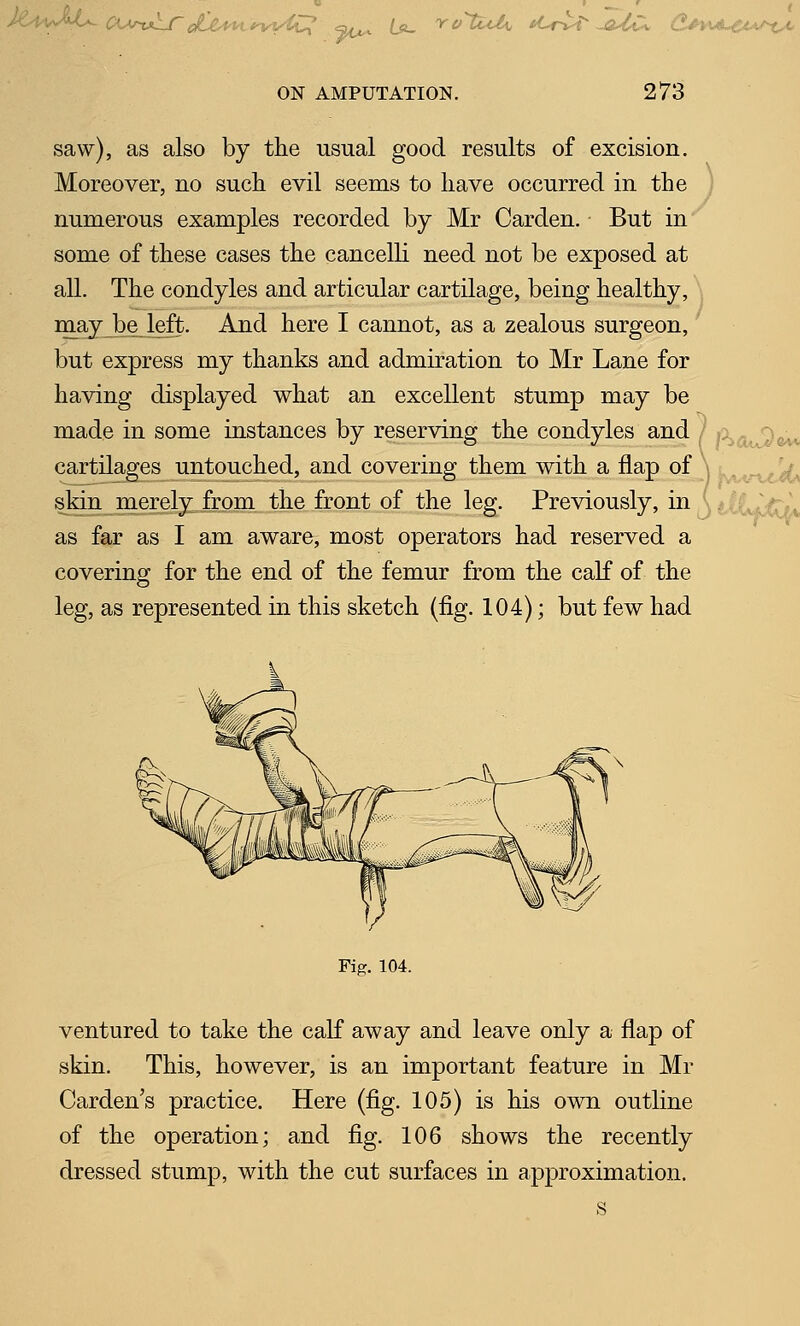 saw), as also by the usual good results of excision. Moreover, no such evil seems to have occurred in the i numerous examples recorded by Mr Garden. But in some of these cases the cancelH need not be exposed at all. The condyles and articular cartilage, being healthy, may_be_left. And here I cannot, as a zealous surgeon, but express my thanks and admiration to Mr Lane for having displayed what an excellent stump may be made in some instances by reserving the condyles and / Aq^^i;^ cartilages untouched, and covering them with a flap of \ u^^^^^ skin merely: from the front of the leg. Previously, in (titJj^ as far as I am aware, most operators had reserved a covering for the end of the femur from the calf of the leg, as represented in this sketch (fig. 104); but few had Fig. 104. ventured to take the calf away and leave only a flap of skin. This, however, is an important feature in Mr Garden's practice. Here (fig. 105) is his own outline of the operation; and fig. 106 shows the recently dressed stump, with the cut surfaces in approximation. s