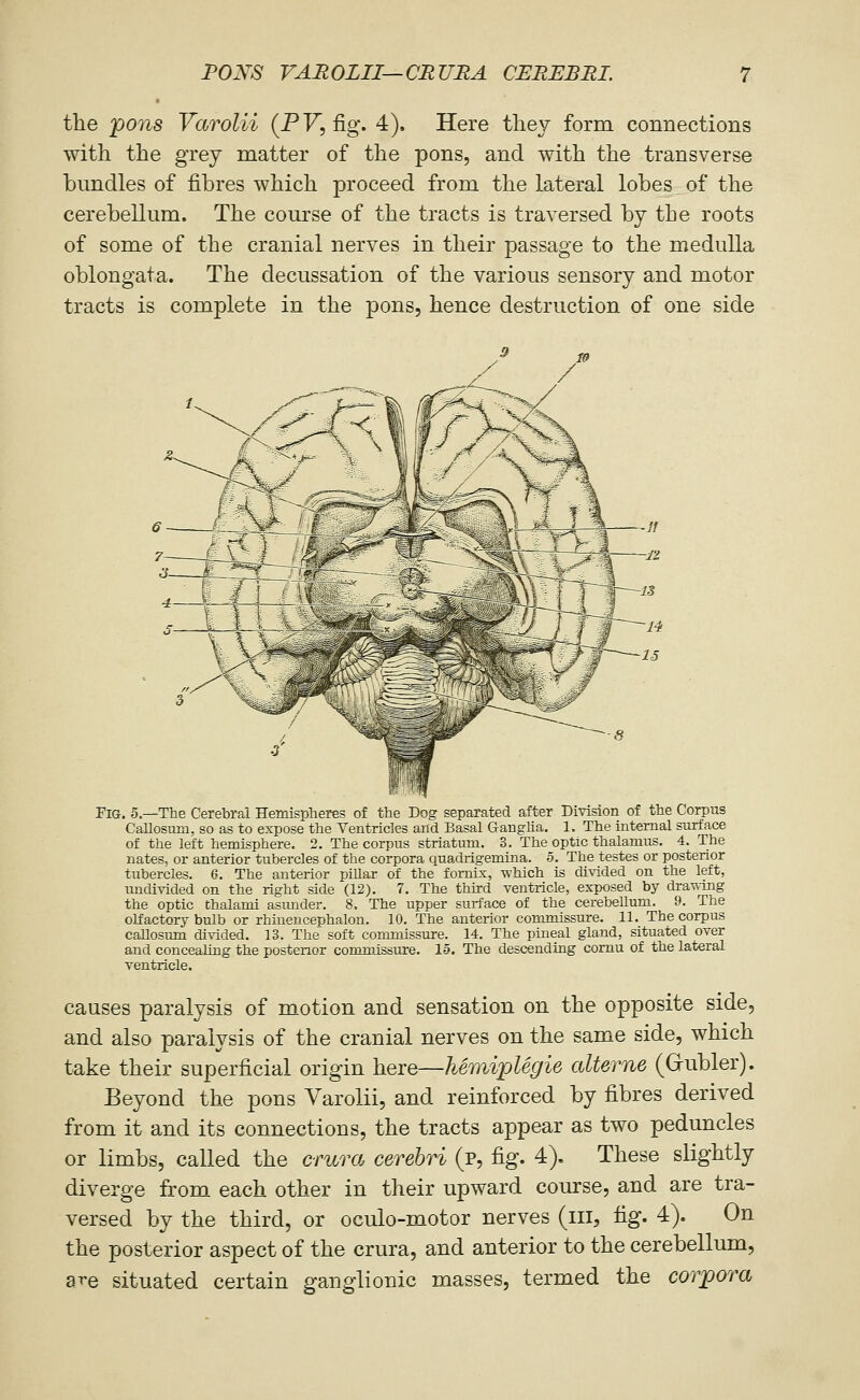 • the pons Varolii (PF, fig. 4). Here tliey form connections with the grey matter of the pons, and with the transverse bundles of fibres which proceed from the lateral lobes of the cerebellum. The course of the tracts is traversed by the roots of some of the cranial nerves in their passage to the medulla oblongata. The decussation of the various sensory and motor tracts is complete in the pons, hence destruction of one side 6~ Fig. 5.—'The Cerebral Hemispheres of the Dog separated after Division of the Corpus CaUosum, so as to expose the Ventricles and Basal Ganglia. 1. The internal surface of the left hemisphere. 2. The corpus striatum. 3. The optic thalamus. 4. The nates, or anterior tubercles of the corpora quadrigemina. 5. The testes or posterior tubercles. 6. The anterior piUar of the fornix, which is divided on the left, imdivided on the right side (12). 7. The third ventricle, exposed by dra\\ing the optic thalami asimder. 8. The upper surface of the cerebellum. 9. The olfactory bulb or rhinencephalon. 10. The anterior commissure. 11. The corpus caUosimi divided. 13. The soft commissure. 14. The pineal gland, situated over and concealing the posterior commissure. 15. The descending cornu of the lateral ventricle. causes paralysis of motion and sensation on the opposite side, and also paralysis of the cranial nerves on the same side, which take their superficial origin here—hemiplegie alterne (Gubler). Beyond the pons Varolii, and reinforced by fibres derived from it and its connections, the tracts appear as two peduncles or limbs, called the crura cerebri (p, fig. 4). These slightly diverge from each other in their upward course, and are tra- versed by the third, or oculo-motor nerves (iii, tig. 4). On the posterior aspect of the crura, and anterior to the cerebellum, are situated certain ganglionic masses, termed the corpora