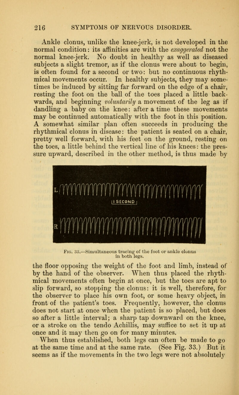 Ankle clonus, unlike the knee-jerk, is not developed in the normal condition: its affinities are with the exaggerated not the normal knee-jerk. No doubt in healthy as well as diseased subjects a slight tremor, as if the clonus were about to begin, is often found for a second or two: but no continuous rhyth- mical movements occur. In healthy subjects, they may some- times be induced by sitting far forward on the edge of a chair, resting the foot on the ball of the toes placed a little back- wards, and beginning voluntarily a movement of the leg as if dandling a baby on the knee: after a time these movements may be continued automatically with the foot in this position. A somewhat similar plan often succeeds in producing the rhythmical clonus in disease: the patient is seated on a chair, pretty well forward, with his feet on the ground, resting on the toes, a little behind the vertical line of his knees: the pres- sure upward, described in the other method, is thus made by Fig. 38.—Simultaneous tracing of the foot or ankle clonus in both legs. the floor opposing the weight of the foot and limb, instead of by the hand of the observer. When thus placed the rhyth- mical movements often begin at once, but the toes are apt to slip forward, so stopping the clonus: it is well, therefore, for the observer to place his own foot, or some heavy object, in front of the patient's toes. Frequently, however, the clonus does not start at once when the patient is so placed, but does so after a little interval; a sharp tap downward on the knee, or a stroke on the tendo Achillis, may suffice to set it up at once and it may then go on for many minutes. When thus established, both legs can often be made to go at the same time and at the same rate. (See Fig. 33.) But it seems as if the movements in the two legs were not absolutely