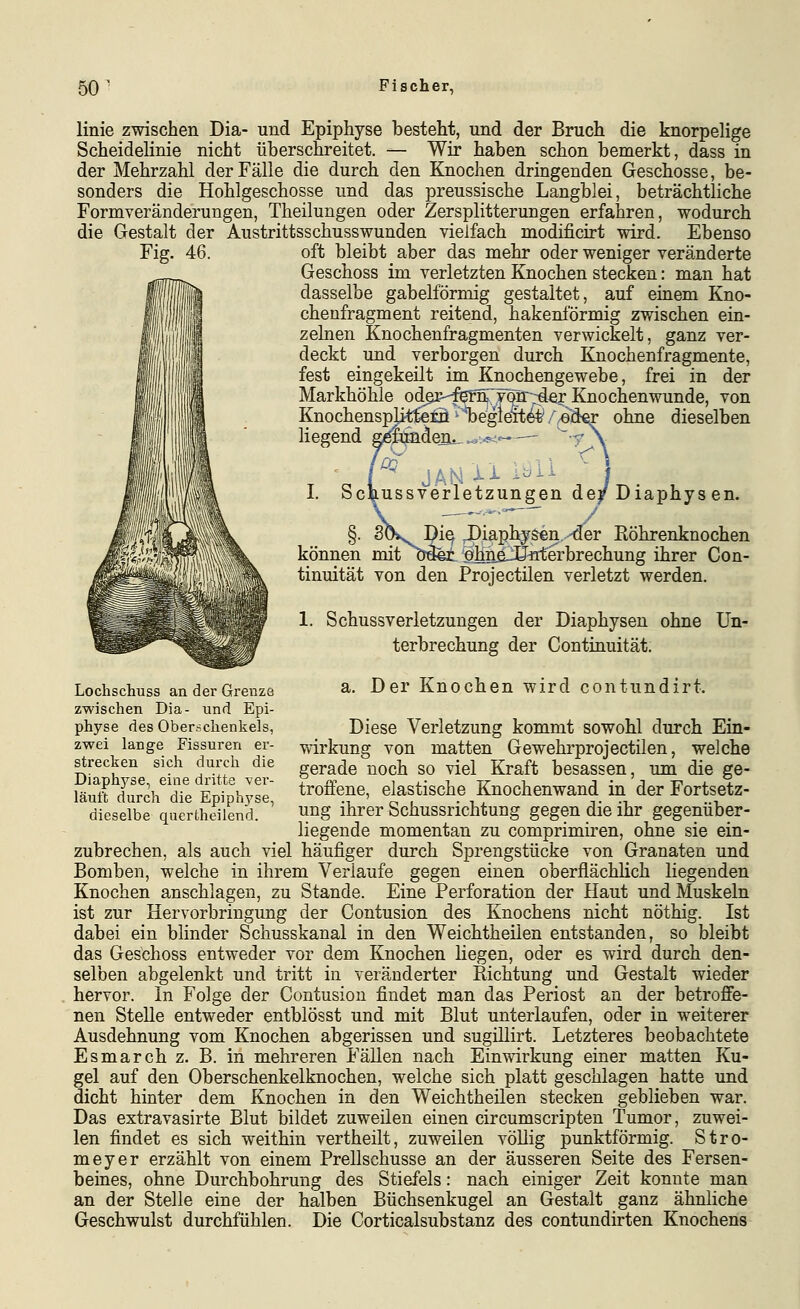 linie zwischen Dia- und Epiphyse besteht, und der Bruch die knorpelige Scheidelinie nicht überschreitet. — Wir haben schon bemerkt, dass in der Mehrzahl der Fälle die durch den Knochen dringenden Geschosse, be- sonders die Hohlgeschosse und das preussische Langblei, beträchtliche Formveränderungen, Theilungen oder Zersplitterungen erfahren, wodurch die Gestalt der Austrittsschusswunden vielfach modificirt wird. Ebenso Fig. 46. oft bleibt aber das mehr oder weniger veränderte Geschoss im verletzten Knochen stecken: man hat dasselbe gabelförmig gestaltet, auf einem Kno- chenfragment reitend, hakenförmig zwischen ein- zelnen Knochenfragmenten verwickelt, ganz ver- deckt und verborgen durch Knochenfragmente, fest eingekeilt im Knochengewebe, frei in der Markhöhle od^r^-^njTcar^er Knochen wunde, von Knochenspjittetä' Ibegieit^ /'si liegend g^lüadeß^,...,.?^'- .Ü ii ssverletzungen dej Lochsctuss an der Grenze zwischen Dia- und Epi- physe des Oberschenkels, zwei lange Fissuren er- strecken sich durch die Diaphyse, eine dritte ver- läuft durch die Epiphyse, dieselbe quertheiiend. ohne dieselben Diaphysen. JDiaphy&en.-der Röhrenknochen können mit bä^i a*hnE-üirterbrechung ihrer Con- tinuität von den Projectilen verletzt werden. 1. SchussVerletzungen der Diaphysen ohne Un- terbrechung der Continuität. a. Der Knochen wird contundirt. Diese Verletzung kommt sowohl durch Ein- wirkung von matten Gewehrprojectilen, welche gerade noch so viel Kraft besassen, um die ge- troffene, elastische Knochenwand in der Fortsetz- ung ihrer Schussrichtung gegen die ihr gegenüber- liegende momentan zu comprimiren, ohne sie ein- zubrechen, als auch viel häufiger durch Sprengstücke von Granaten und Bomben, welche in ihrem Verlaufe gegen einen oberflächlich liegenden Knochen anschlagen, zu Stande. Eine Perforation der Haut und Muskeln ist zur Hervorbringung der Contusion des Knochens nicht nöthig. Ist dabei ein blinder Schusskanal in den Weichtheilen entstanden, so bleibt das Geschoss entweder vor dem Knochen liegen, oder es wird durch den- selben abgelenkt und tritt in veränderter Richtung und Gestalt wieder hervor. In Folge der Contusion findet man das Periost an der betroflfe- nen Stelle entweder entblösst und mit Blut unterlaufen, oder in weiterer Ausdehnung vom Knochen abgerissen und sugiUirt. Letzteres beobachtete Esmarch z. B. in mehreren FäUen nach Einwirkung einer matten Ku- gel auf den Oberschenkelknochen, welche sich platt geschlagen hatte und dicht hinter dem Knochen in den Weichtheilen stecken geblieben war. Das extravasirte Blut bildet zuweilen einen circumscripten Tumor, zuwei- len findet es sich w^eithin vertheilt, zuweilen völlig punktförmig. Stro- meyer erzählt von einem Prellschusse an der äusseren Seite des Fersen- beines, ohne Durchbohrung des Stiefels: nach einiger Zeit konnte man an der Stelle eine der halben Büchsenkugel an Gestalt ganz ähnliche Geschwulst durchfühlen. Die Corticalsubstanz des contundirten Knochens