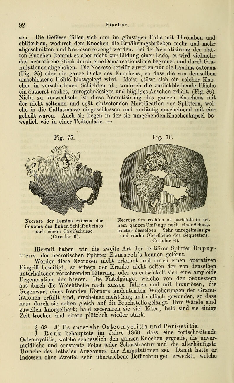 sen. Die Gefässe füllen sich nun im günstigen Falle mit Thromben und obliteriren, wodurch dem Knochen die Ernährungsbrücken mehr und mehr abgeschnitten und Necrosen erzeugt werden. Bei derNecrotisirung der plat- ten Knochen kommt es aber nicht zur Bildung einer Lade, es wird vielmehr das necrotische Stück durch eineDemarcationslinie begrenzt und durch Gra- nulationen abgehoben. Die Necrose betrifft zuweilen nur die Lamina externa (Fig. 85) oder die ganze Dicke des Knochens, so dass die von demselben umschlossene Höhle blossgelegt wird. Meist stösst sich ein solcher Kno- chen in verschiedenen Schichten ab, wodurch die zurückbleibende Fläche ein äusserst rauhes, unregelmässiges und hügliges Ansehen erhält. (Fig. 86). Nicht zu verwechseln ist diese Necrotisirung des ganzen Knochens mit der nicht seltenen und spät eintretenden Mortification von Splittern, wel- che in die Callusmasse eingeschlossen und vorläufig anscheinend mit ein- geheilt waren. Auch sie liegen in der sie umgebenden Knochenkapsel be- wegUch wie in einer Todtenlade. — Fig. 75. Fig. 76. Necrose der Laraina externa der Squama des linken Schläfenbeines nach einem Streifschusse. (Circular 6). Necrose des rechten os parietale in sei- nem ganzen Umfange nach einer Schuss- fractur desselben. Sehr unregelmässige und rauhe Oberfläche des Sequesters. (Circular 6). Hiermit haben wir die zweite Art der tertiären Splitter Dupuy- trens, der necrotischen Splitter Esmarch's kennen gelernt. Werden diese Necrosen nicht erkannt und durch einen operativen Eingriff beseitigt, so erliegt der Kranke nicht selten der von denselben unterhaltenen verzehrenden Eiterung, oder es entwickelt sich eine amyloide Degeneration der Nieren. Die Fistelgänge, welche von den Sequestern aus durch die Weichtheile nach aussen führen und mit luxuriösen, die Gegenwart eines fremden Körpers andeutenden Wucherungen der Granu- lationen erfüllt sind, erscheinen meist lang und -sdelfach gewunden, so dass man durch sie selten gleich auf die Bruchstelle gelangt. Ihre Wände sind zuweilen knorpelhart; bald secerniren sie viel Eiter, bald sind sie einige Zeit trocken und eitern plötzlich wieder stark. §. 68. 3) Es entsteht Osteomyelitis und Periostitis. J. Roux behauptete im Jahre 1860, dass eine fortschreitende Osteomyelitis, welche schliesslich den ganzen Knochen ergreife, die unver- meidliche und constante Folge jeder Schussfractur und die allerhäufigste Ursache des lethalen Ausganges der Amputationen sei. Damit hatte er indessen ohne Zweifel sehr übertriebene Befürchtungen erweckt, welche