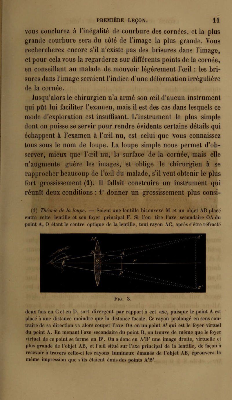 vous conclurez à l'inégalité de courbure des cornées, et la plus grande courbure sera du côté de l'image la plus grande. Vous rechercherez encore s'il n'existe pas des brisures dans l'image, et pour cela vous la regarderez sur différents points de la cornée, en conseillant au malade de mouvoir légèrement l'œil : les bri- sures dans l'image seraient l'indice d'une déformation irrégulière de la cornée. Jusqu'alors le chirurgien n'a armé son œil d'aucun instrument qui pût lui faciliter l'examen, mais il est des cas dans lesquels ce mode d'exploration est insuffisant. L'instrument le plus simple dont on puisse se servir pour rendre évidents certains détails qui échappent à l'examen à l'œil nu, est celui que vous connaissez tous sous le nom de loupe. La loupe simple nous permet d'ob- server, mieux que l'œil nu, la surface de la cornée, mais elle n'augmente guère les images, et oblige le chirurgien à se rapprocher beaucoup de l'œil du malade, s'il veut obtenir le plus fort grossissement (1). Il fallait construire un instrument qui réunît deux conditions : 1° donner un grossissement plus consi- (1) Théorie de la loupe. — Soient une lentille biconvexe M et un objet AB placé entre cette lentille et son foyer principal F. Si l'on tire l'axe secondaire OA du point A, 0 étant le centre optique de la lentille, tout rayon AC, après s'être réfracté Fig. 3. deux fois en G et en D, sort divergent par rapport a cet axe, puisque le point A est placé à une distance moindre que la distance focale. Ce rayon prolongé en sens con- traire de sa direction va alors couper l'axe OA en un point A' qui est le foyer virtuel du point A. En menant l'axe secondaire du point B, on trouve de même que le foyer virtuel de ce point se forme en B'. On a donc en A'B' une image droite, virtuelle et plus grande de l'objet AB, et l'œil situé sur l'axe principal de la lentille, de façon à recevoir à travers celle-ci les rayons lumineux émanés de l'objet AB, éprouvera la même impression que s'ils étaient émis des points A'B'.