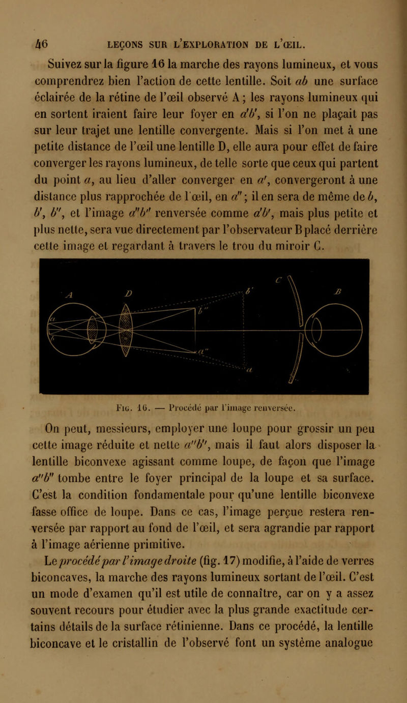 Suivez sur la figure 16 la marche des rayons lumineux, et vous comprendrez bien l'action de cette lentille. Soit ab une surlace éclairée de la rétine de l'oeil observé A ; les rayons lumineux qui en sortent iraient faire leur foyer en db\ si l'on ne plaçait pas sur leur trajet une lentille convergente. Mais si l'on met à une petite distance de l'œil une lentille D, elle aura pour effet de faire converger les rayons lumineux, de telle sorte que ceux qui partent du point a, au lieu d'aller converger en a', convergeront à une distance plus rapprochée de l'œil, en a; il en sera de même de b, //, b'\ et l'image ab'r renversée comme a'b', mais plus petite et plus nette, sera vue directement par l'observateur B placé derrière cette image et regardant à travers le trou du miroir G. Fig. 16. — Procédé par L'image renversée. On peut, messieurs, employer une loupe pour grossir un peu cette image réduite et nette ab'f, mais il faut alors disposer la lentille biconvexe agissant comme loupe, de façon que l'image ab tombe entre le foyer principal de la loupe et sa surface. C'est la condition fondamentale pour qu'une lentille biconvexe fasse office de loupe. Dans ce cas, l'image perçue restera ren- versée par rapport au fond de l'œil, et sera agrandie par rapport à l'image aérienne primitive. Le procédé parl'image droite (fig. 17) modifie, à l'aide de verres biconcaves, la marche des rayons lumineux sortant de l'œil. C'est un mode d'examen qu'il est utile de connaître, car on y a assez souvent recours pour étudier avec la plus grande exactitude cer- tains détails de la surface rétinienne. Dans ce procédé, la lentille biconcave et le cristallin de l'observé font un système analogue