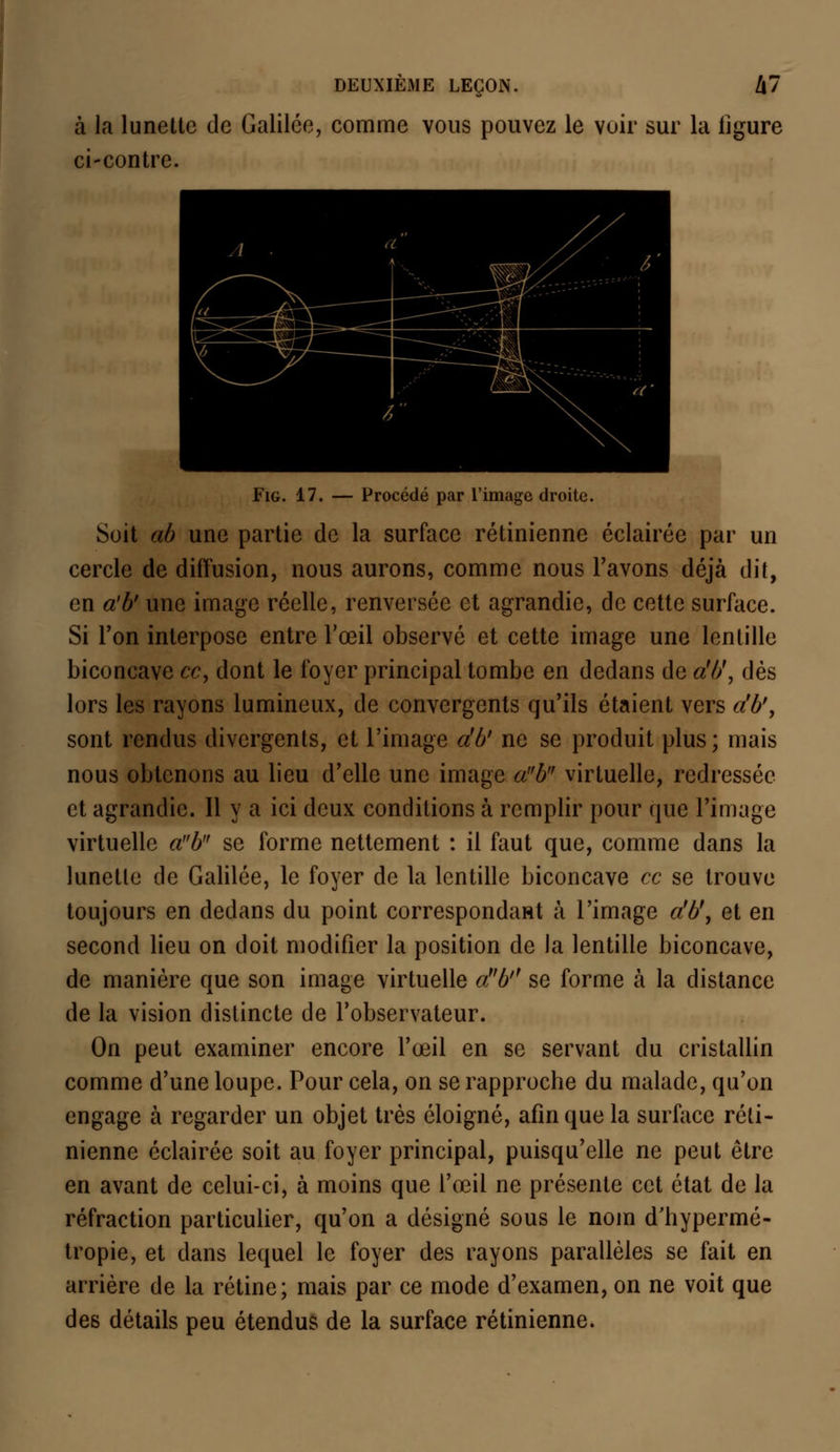 à la lunette de Galilée, comme vous pouvez le vuir sur la ligure ci-contre. Fig. 17. — Procédé par l'image droite. Soit ab une partie de la surface rétinienne éclairée par un cercle de diffusion, nous aurons, comme nous l'avons déjà dit, en a'b' une image réelle, renversée et agrandie, de cette surface. Si l'on interpose entre l'œil observé et cette image une lentille biconcave ce, dont le foyer principal tombe en dedans de a'b', dés lors les rayons lumineux, de convergents qu'ils étaient vers a'b', sont rendus divergents, et l'image a'b' ne se produit plus; mais nous obtenons au lieu d'elle une image ab virtuelle, redressée et agrandie. Il y a ici deux conditions à remplir pour que l'image virtuelle ab se forme nettement : il faut que, comme dans la lunette de Galilée, le foyer de la lentille biconcave ce se trouve toujours en dedans du point correspondait à l'image a'b', et en second lieu on doit modifier la position de la lentille biconcave, de manière que son image virtuelle ab'' se forme à la distance de la vision distincte de l'observateur. On peut examiner encore l'œil en se servant du cristallin comme d'une loupe. Pour cela, on se rapproche du malade, qu'on engage à regarder un objet très éloigné, afin que la surface réti- nienne éclairée soit au foyer principal, puisqu'elle ne peut être en avant de celui-ci, à moins que l'œil ne présente cet état de la réfraction particulier, qu'on a désigné sous le nom d'hypermé- tropie, et dans lequel le foyer des rayons parallèles se fait en arrière de la rétine; mais par ce mode d'examen, on ne voit que des détails peu étendus de la surface rétinienne.