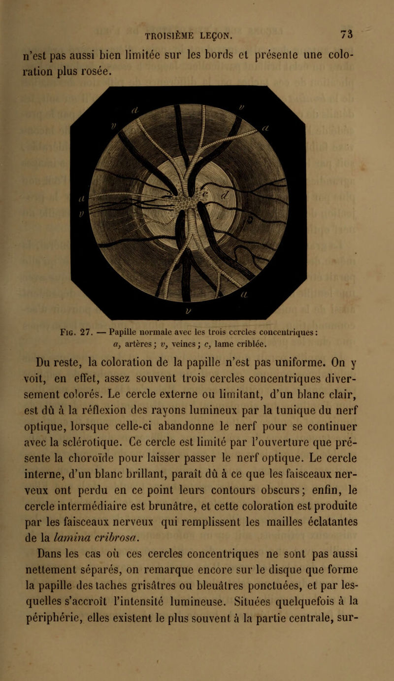 n'est pas aussi bien limitée sur les bords et présente une colo- ration plus rosée. Fig. 27. — Papille normale avec les trois cercles concentriques: a, artères; v, veines; c, lame criblée. Du reste, la coloration de la papille n'est pas uniforme. On y voit, en effet, assez souvent trois cercles concentriques diver- sement colorés. Le cercle externe ou lirnilant, d'un blanc clair, est dû à la réflexion des rayons lumineux par la tunique du nerf optique, lorsque celle-ci abandonne le nerf pour se continuer avec la sclérotique. Ce cercle est limité par l'ouverture que pré- sente la choroïde pour laisser passer le nerf optique. Le cercle interne, d'un blanc brillant, paraît dû à ce que les faisceaux ner- veux ont perdu en ce point leurs contours obscurs; enfin, le cercle intermédiaire est brunâtre, et cette coloration est produite par les faisceaux nerveux qui remplissent les mailles éclatantes de la lamina cribrosa. Dans les cas où ces cercles concentriques ne sont pas aussi nettement séparés, on remarque encore sur le disque que forme la papille des taches grisâtres ou bleuâtres ponctuées, et par les- quelles s'accroît l'intensité lumineuse. Situées quelquefois à la périphérie, elles existent le plus souvent à la partie centrale, sur-