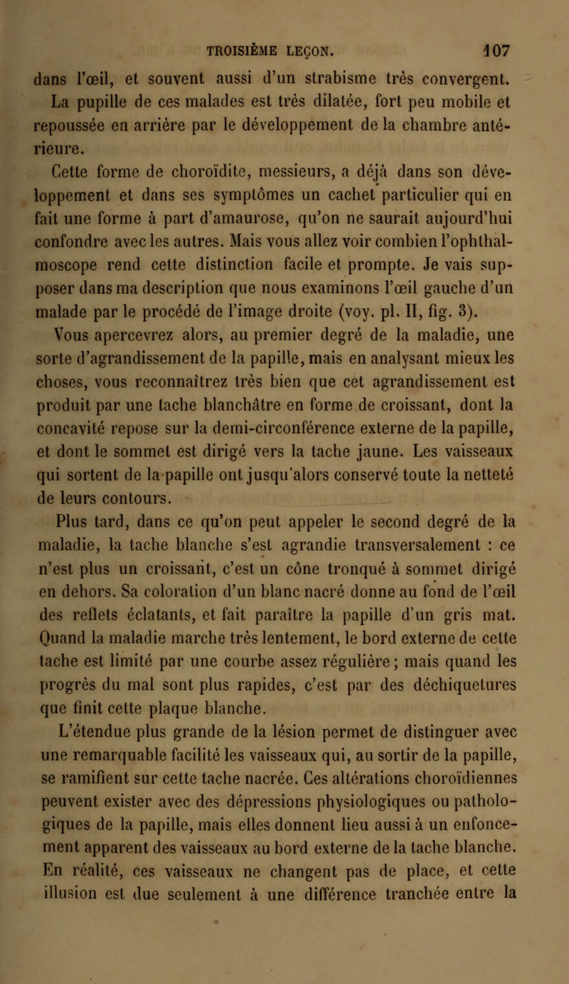 dans l'œil, et souvent aussi d'un strabisme très convergent. La pupille de ces malades est très dilatée, fort peu mobile et repoussée en arrière par le développement de la cbambre anté- rieure. Cette forme de choroïdite, messieurs, a déjà dans son déve- loppement et dans ses symptômes un cachet particulier qui en fait une forme à part d'amaurose, qu'on ne saurait aujourd'hui confondre avec les autres. Mais vous allez voir combien l'ophthal- moscope rend cette distinction facile et prompte. Je vais sup- poser dans ma description que nous examinons l'œil gauche d'un malade par le procédé de l'image droite (voy. pi. II, fig. 3). Vous apercevrez alors, au premier degré de la maladie, une sorte d'agrandissement de la papille, mais en analysant mieux les choses, vous reconnaîtrez très bien que cet agrandissement est produit par une tache blanchâtre en forme de croissant, dont la concavité repose sur la demi-circonférence externe de la papille, et dont le sommet est dirigé vers la tache jaune. Les vaisseaux qui sortent de la papille ont jusqu'alors conservé toute la netteté de leurs contours. Plus tard, dans ce qu'on peut appeler le second degré de la maladie, la tache blanche s'est agrandie transversalement : ce n'est plus un croissant, c'est un cône tronqué à sommet dirigé en dehors. Sa coloration d'un blanc nacré donne au fond de l'œil des rellels éclatants, et fait paraître la papille d'un gris mat. Quand la maladie marche très lentement, le bord externe de cette tache est limité par une courbe assez régulière ; mais quand les progrès du mal sont plus rapides, c'est par des déchiquetures que finit cette plaque blanche. L'étendue plus grande de la lésion permet de distinguer avec une remarquable facilité les vaisseaux qui, au sortir de la papille, se ramifient sur cette tache nacrée. Ces altérations choroïdiennes peuvent exister avec des dépressions physiologiques ou patholo- giques de la papille, mais elles donnent lieu aussi à un enfonce- ment apparent des vaisseaux au bord externe de la tache blanche. En réalité, ces vaisseaux ne changent pas de place, et cette illusion est due seulement à une différence tranchée entre la