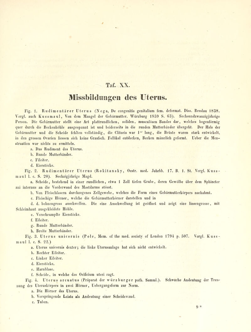 Taf. XX. . MissbildMigeii des Uterus. Fig. 1. Riidimeutärer Uterus (Ncga, De congenilis genitalium fem. deformat. Diss. Breslau 1838. Vergl. auch Kussmaul, Von dem Mangel der Gebärmutter. Würzburg 1859 S. 63). Sechsundzwanzigjährige Person. Die Gebärmutter stellt eine Art plattrundlichen, soliden, musculösen Bandes dar, welches bogenförmig quer durch die Beclienhöhle ausgespannt ist und beiderseits in die runden Mutterländer übergeht. Der Hals der Gebärmutter und die Scheide fehlten vollständig, die Clitoris war i lang, die Brüste waren stark entwickelt, in den grossen Ovarien Hessen sich keine Graafsch. Follikel entdecken, Becken männlich geformt. Ueber die Men- struation war nichts zu ermitteln. a. Das Rudiment des Uterus. b. Bunde Mutlerbänder. c. Fileiter. d. Eierstöcke. Fig. 2. Rudimentärer Uterus (Rokitansky, Oestr. med. Jahrbb. 17. B. 1. St. Vcrgl. Kuss- maul 1. c. S. 20). Sechzigjährige Magd. a. Scheide, bestehend in einer rundlichen, etwa 1 Zoll tiefen Grube, deren Gewölbe über dem Sphincter ani internus an die Vorderwand des Mastdarms stösst. b. Von Fleischfasern durchzogenes Zellgewebe, welches die Form eines Gebärmutterkörpers nachahmt. c. Fleischige Hörner, welche die Gebärmutterhörner darstellen und in d. d. bohuengross anschwellen. Die eine Anschwellung ist geöffnet und zeigt eine linscngrosse, mit Schleimhaut ausgekleidete Höhle. e. Verschrumpfte Eierstöcke. . f. Eileiter. g. Runde Mutterbänder, h. Breite Mutterbänder. Fig. 3. Uterus unicornis (Pole, Mera. of the med. society of London 1794 p. 507. Vergl. Kuss- maul 1. c. S. 22.) a. Uterus unicornis dexter; die linke Uterusanlage hat sich nicht entwickelt. b. Rechter Eileiter. . - , c. Linker Eileiter. d. Eierstöcke. e. Harnblase. • , f. Scheide, in welche das Orificium uteri ragt. Fig. 4. Uterus arcuatus (Präparat der Würzburger path. Samml.). Schwache Andeutung der Tren- nung des Uteruskörpers in zwei Hörner, Uebergangsform zur Norm. a. Die Hörner des Uterus. b. Vorspringende Leiste als Andeutung einer Scheidewand. c. Tuben. ' 9*