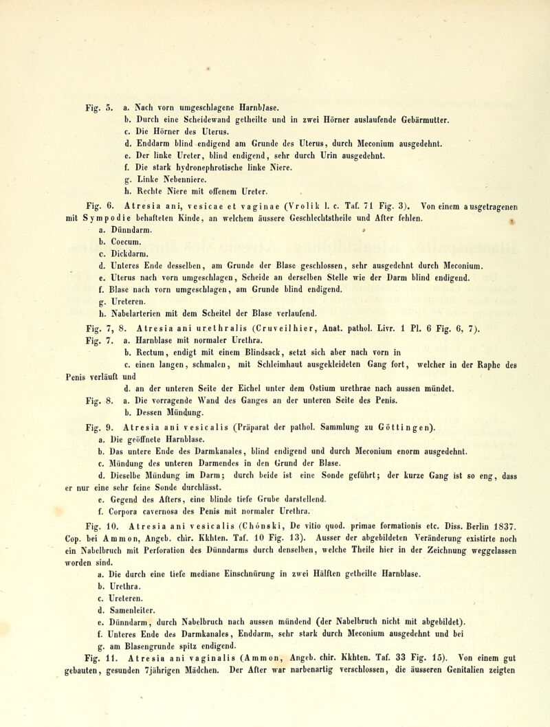 b. Durch eine Scheidewand gelheilte und in zwei Hörner auslaufende Gebärmutter. c. Die Hörner des Uterus. d. Enddarm blind endigend am Grunde des Uterus, durch Meconium ausgedehnt. e. Der linke Ureter, blind endigend, sehr durch Urin ausgedehnt. f. Die stark hydronephrotische linke Niere. g. Linke Nebenniere. h. Rechte Niere mit ofTenem Ureter. Fig. 6. Atresia ani, vesicae et vaginae (Vrolik 1. c. Taf. 71 Fig. 3). Von einem ausgetragenen mit S y m p 0 d i e behafteten Kinde, an welchem äussere Geschlechlslheile und After fehlen. « a. Dünndarm. .> b. Coecum. C. Dickdarm. d. Unteres Ende desselben, am Grunde der Blase geschlossen, sehr ausgedehnt durch Meconium. e. Uterus nach vorn umgeschlagen, Scheide an derselben Stelle wie der Darm blind endigend. f. Blase nach vorn umgeschlagen, am Grunde blind endigend. g. Ureteren. h. Nabelarterien mit dem Scheitel der Blase verlaufend. Fig. 7, 8. Atresia ani urethralis (Cruveilhier, Anat. pathol. Livr. 1 PI. 6 Fig. 6, 7). Fig. 7. a. Harnblase mit normaler Urethra. b. Rectum, endigt mit einem Blindsack, setzt sich aber nach vorn in c. einen langen, schmalen, mit Schleimhaut ausgekleideten Gang fort, welcher in der Raphc des Penis verläuft und d. an der unteren Seite der Eichel unter dem Ostium urethrae nach aussen mündet. Fig. 8. a. Die vorragende Wand des Ganges an der unteren Seite des Penis. b. Dessen Mündung. Fig. 9. Atresia ani vesicalis (Präparat der pathol. Sammlung zu Göttingen). a. Die geöffnete Harnblase. b. Das untere Ende des Darmkanales, blind endigend und durch Meconium enorm ausgedehnt. c. Mündung des unteren Darmendes In den Grund der Blase. d. Dieselbe Mündung im Darm; durch beide ist eine Sonde geführt; der kurze Gang ist so eng, dass er nur eine sehr feine Sonde durchlässt. e. Gegend des Afters, eine blinde tiefe Grube darstellend. f. Corpora cavernosa des Penis mit normaler Urethra. Fig. 10. Atresia ani vesicalis (Chönski, De vitio quod. primae formationis etc. Diss. Berlin 1837. Cop. bei Amnion, Angeb. chir. Kkhten. Taf. 10 Fig. 13). Ausser der abgebildeten Veränderung cxistirte noch ein Nabelbruch mit Perforation des Dünndarms durch denselben, welche Theile hier in der Zeichnung weggelassen worden sind. a. Die durch eine liefe mediane Einschnürung in zwei Hälften gelheilte Harnblase. b. Urethra. c. Ureteren. d. Samenleiter. e. Dünndarm, durch Nabelbruch nach aussen mündend (der Nabelbruch nicht mit abgebildet). f. Unteres Ende des Darmkanales, Enddarm, sehr stark durch Meconium ausgedehnt und bei g. am Blasengrunde spitz endigend. Fig. 11. Atresia ani vaginalis (Ammon, Angcb. chir. Kkhten. Taf. 33 Fig. 15). Von einem gut gebauten, gesunden 7jährigen Mädchen. Der After war narbenarlig verschlossen, die äusseren Genitalien zeigten