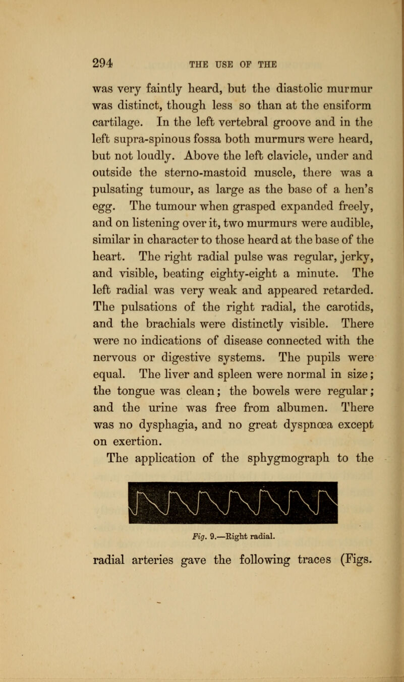 was very faintly heard, but the diastolic murmur was distinct, though less so than at the ensiform cartilage. In the left vertebral groove and in the left supra-spinous fossa both murmurs were heard, but not loudly. Above the left clavicle, under and outside the sterno-mastoid muscle, there was a pulsating tumour, as large as the base of a hen's egg. The tumour when grasped expanded freely, and on listening over it, two murmurs were audible, similar in character to those heard at the base of the heart. The right radial pulse was regular, jerky, and visible, beating eighty-eight a minute. The left radial was very weak and appeared retarded. The pulsations of the right radial, the carotids, and the brachials were distinctly visible. There were no indications of disease connected with the nervous or digestive systems. The pupils were equal. The liver and spleen were normal in size; the tongue was clean; the bowels were regular; and the urine was free from albumen. There was no dysphagia, and no great dyspnoea except on exertion. The application of the sphygmograph to the Fig. 9.—Right radial. radial arteries gave the following traces (Figs.