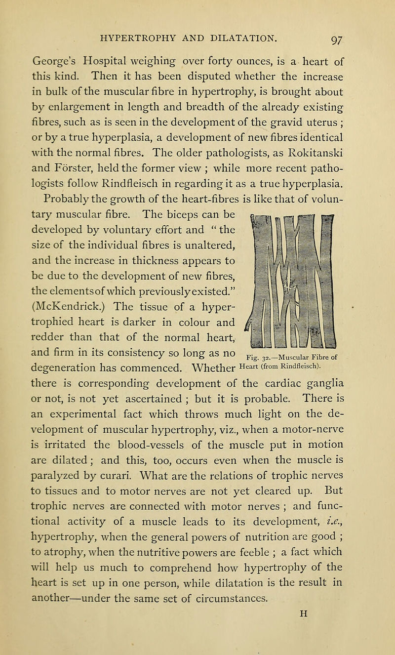 George's Hospital weighing over forty ounces, is a heart of this kind. Then it has been disputed whether the increase in bulk of the muscular fibre in hypertrophy, is brought about by enlargement in length and breadth of the already existing fibres, such as is seen in the development of the gravid uterus ; or by a true hyperplasia, a development of new fibres identical with the normal fibres. The older pathologists, as Rokitanski and Forster, held the former view ; while more recent patho- logists follow Rindfleisch in regarding it as a true hyperplasia. Probably the growth of the heart-fibres is like that of volun- tary muscular fibre. The biceps can be developed by voluntary effort and  the size of the individual fibres is unaltered, and the increase in thickness appears to be due to the development of new fibres, the elementsof which previouslyexisted. (McKendrick.) The tissue of a hyper- trophied heart is darker in colour and redder than that of the normal heart, and firm in its consistency so long as no degeneration has commenced, there is corresponding development of the cardiac ganglia or not, is not yet ascertained ; but it is probable. There is an experimental fact which throws much light on the de- velopment of muscular hypertrophy, viz., when a motor-nerve is irritated the blood-vessels of the muscle put in motion are dilated; and this, too, occurs even when the muscle is paralyzed by curari. What are the relations of trophic nerves to tissues and to motor nerves are not yet cleared up. But trophic nerves are connected with motor nerves ; and func- tional activity of a muscle leads to its development, i.e., hypertrophy, when the general powers of nutrition are good ; to atrophy, when the nutritive powers are feeble ; a fact which will help us much to comprehend how hypertrophy of the heart is set up in one person, while dilatation is the result in another—under the same set of circumstances. H Fig. 32.—Muscular Fibre of Whether Heart (from Rindfleisch).