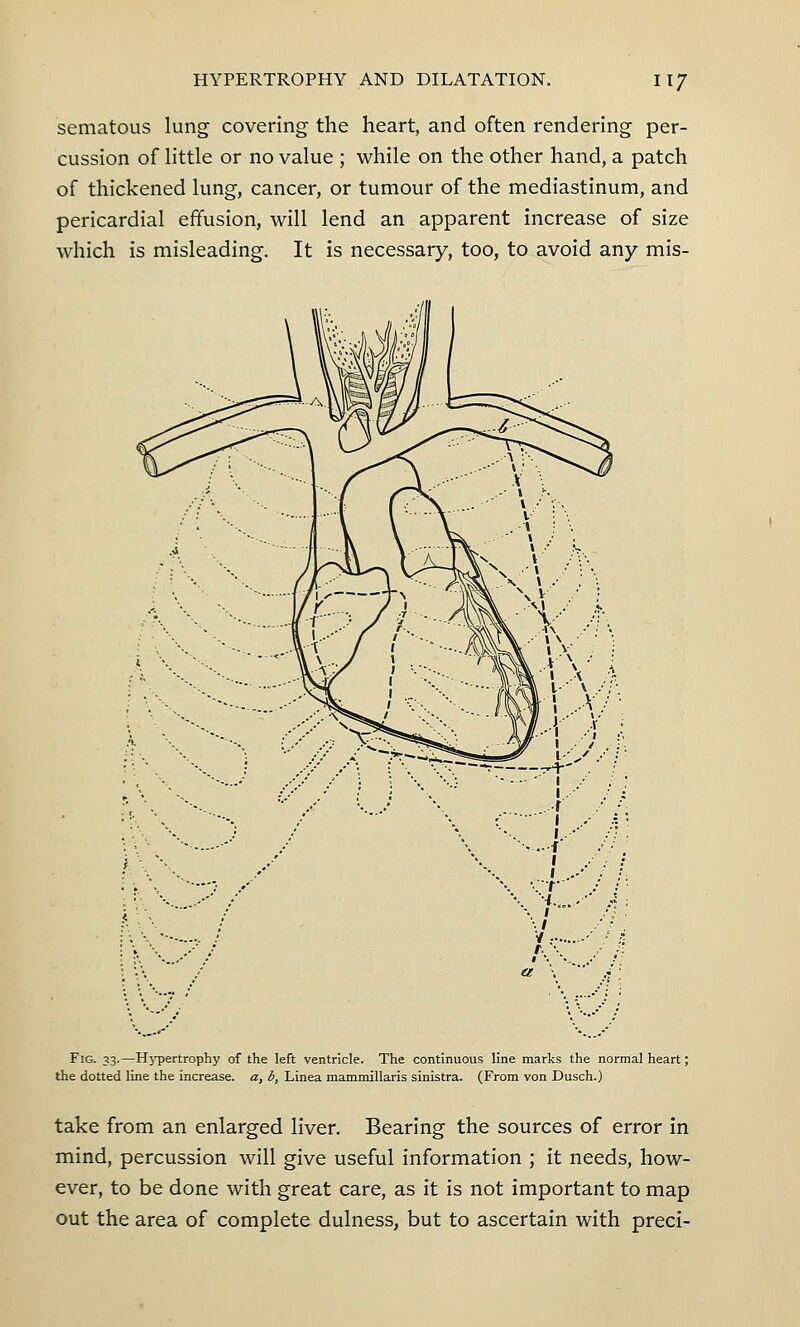 sematous lung covering the heart, and often rendering per- cussion of little or no value ; while on the other hand, a patch of thickened lung, cancer, or tumour of the mediastinum, and pericardial effusion, will lend an apparent increase of size which is misleading. It is necessary, too, to avoid any mis- Fig. 33.—Hj^ertrophy of the left ventricle. The continuous line marks the normal heart; the dotted line the increase, a, b, Linea mammillaris sinistra. (From von Dusch.) take from an enlarged liver. Bearing the sources of error in mind, percussion will give useful information ; it needs, how- ever, to be done with great care, as it is not important to map out the area of complete dulness, but to ascertain with preci-