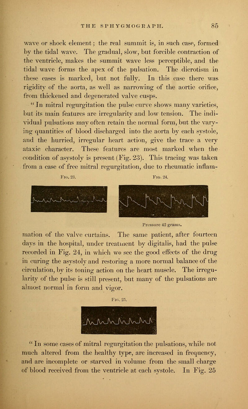 wave or shock element; the real summit is, in such case, formed by the tidal wave. The gradual, slow, but forcible contraction of the ventricle, makes the summit wave less perceptible, and the tidal wave forms the apex of the pulsation. The dicrotism in these eases is marked, but not fully. In this case there was rigidity of the aorta, as well as narrowing of the aortic orifice, from thickened and degenerated valve cusps.  In mitral regurgitation the pulse curve shows many varieties, but its main features are irregularity and low tension. The indi- vidual pulsations may often retain the normal form, but the vary- ing quantities of blood discharged into the aorta by each systole, and the hurried, irregular heart action, give the trace a very ataxic character. These features are most marked when the condition of asystoly is present (Fig. 23). This tracing was taken from a case of free mitral regurgitation, due to rheumatic inflam- Fig. 23. Fig. 24. Pressure 42 grams. mation of the valve curtains. The same patient, after fourteen days in the hospital, under treatment by digitalis, had the pulse recorded in Fig. 24, in which we see the good eifects of the drug in curing the asystoly and restoring a more normal balance of the circulation, by its toning action on the heart muscle. The irregu- larity of the pulse is still present, but many of the pulsations are almost normal in form and vieor. JW\aJVvJV/vJVJWJV  In some cases of mitral regurgitation the pulsations, while not much altered from the healthy type, are increased in frequency, and are incomplete or starved in volume from the small charge of blood received from the ventricle at each systole. In Fig. 25