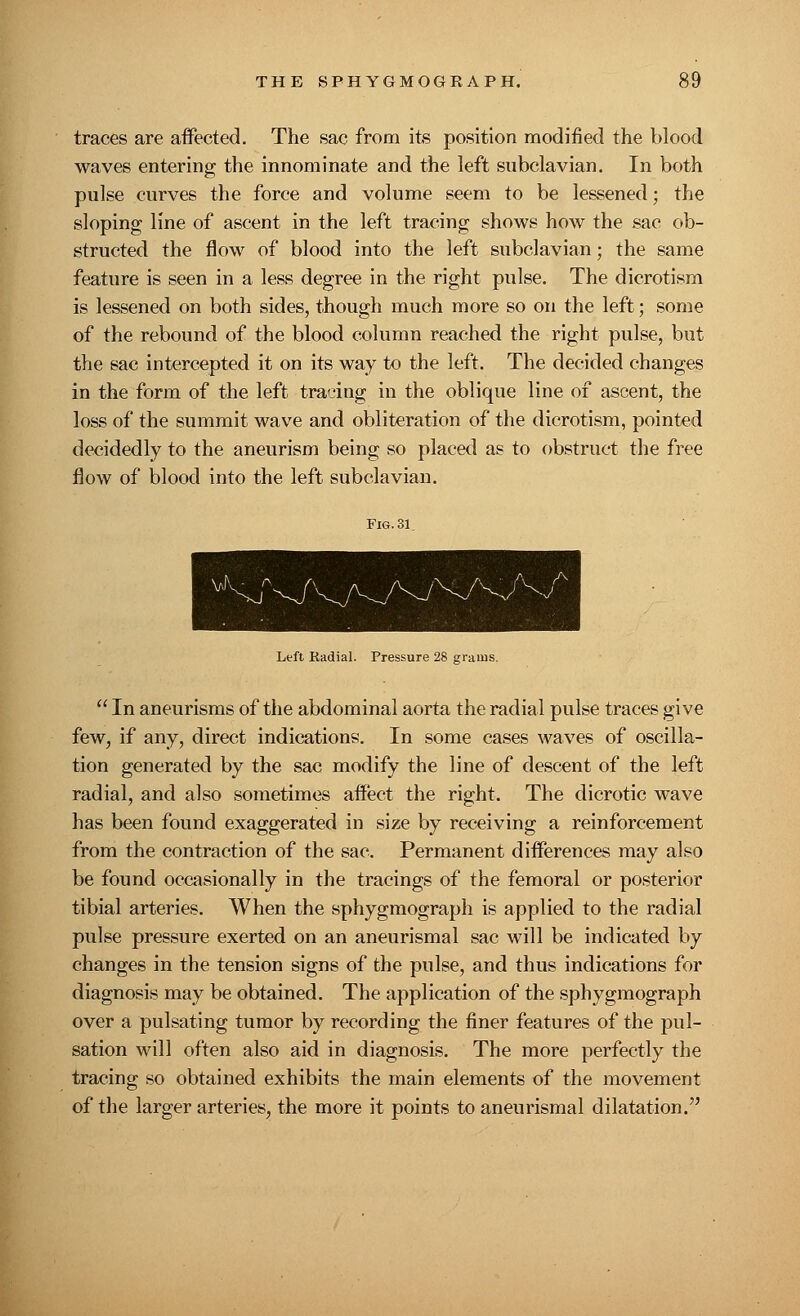 traces are affected. The sac from its position modified the blood waves entering the innominate and the left subclavian. In both pulse curves the force and volume seem to be lessened; the sloping line of ascent in the left tracing shows how the sac ob- structed the flow of blood into the left subclavian; the same feature is seen in a less degree in the right pulse. The dicrotism is lessened on both sides, though much more so on the left; some of the rebound of the blood column reached the right pulse, but the sac intercepted it on its way to the left. The decided changes in the form of the left traeing in the oblique line of ascent, the loss of the summit wave and obliteration of the dicrotism, pointed decidedly to the aneurism being so placed as to obstruct the free flow of blood into the left subclavian. Ltft Radial. Pressure 28 grams.  In aneurisms of the abdominal aorta the radial pulse traces give few, if any, direct indications. In some cases waves of oscilla- tion generated by the sac modify the line of descent of the left radial, and also sometimes affect the right. The dicrotic wave has been found exaggerated in size by receiving a reinforcement from the contraction of the sac. Permanent differences may also be found occasionally in the tracings of the femoral or posterior tibial arteries. When the sphygmograph is applied to the radial pulse pressure exerted on an aneurismal sac will be indicated by changes in the tension signs of the pulse, and thus indications for diagnosis may be obtained. The application of the sphygmograph over a pulsating tumor by recording the finer features of the pul- sation will often also aid in diagnosis. The more perfectly the tracing so obtained exhibits the main elements of the movement of the larger arteries, the more it points to aneurismal dilatation.