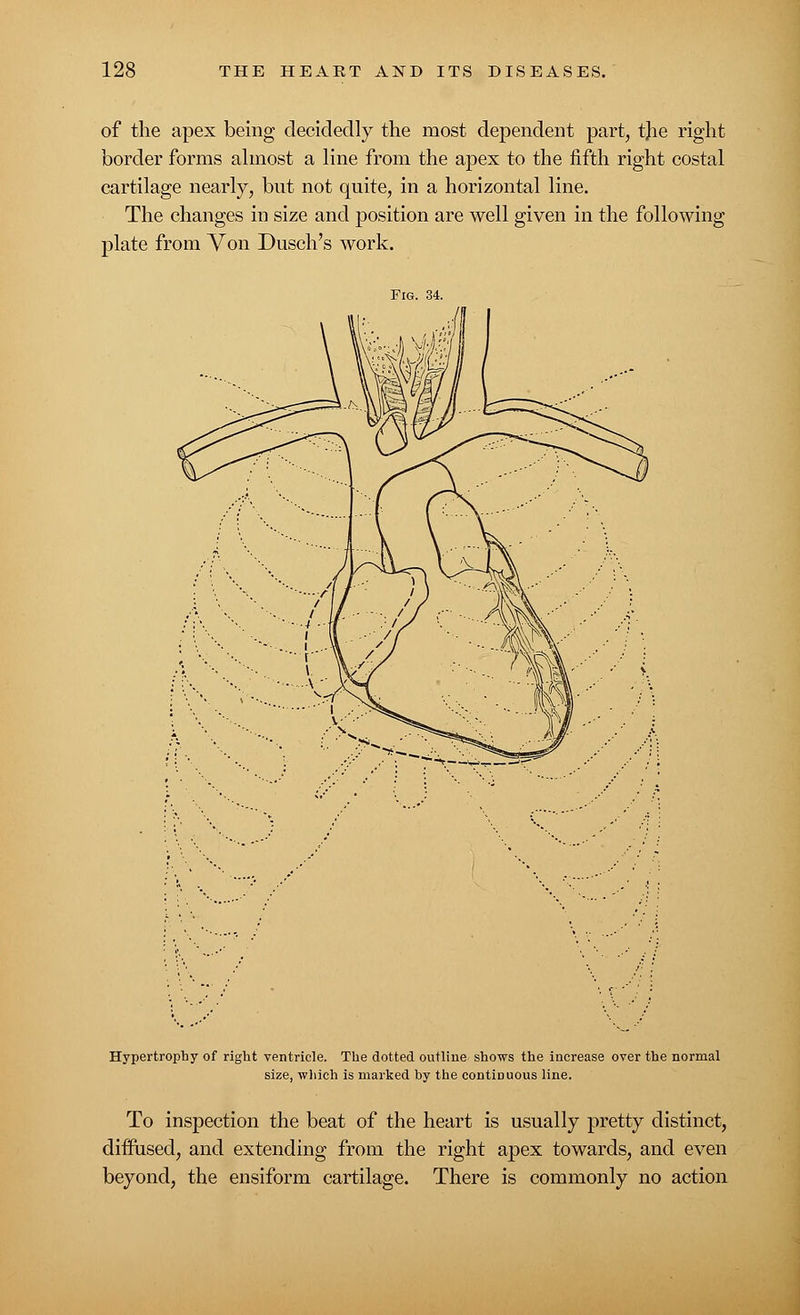 of the apex being decidedly the most dependent part, tjie right border forms almost a line from the apex to the fifth right costal cartilage nearly, but not quite, in a horizontal line. The changes in size and position are well given in the following plate from Von Dusch's work. Fig. 34. Hypertrophy of right ventricle. The dotted outline shows the increase over the normal size, which is marked hy the continuous line. To inspection the beat of the heart is usually pretty distinct, diffused, and extending from the right apex towards, and even beyond, the ensiform cartilage. There is commonly no action