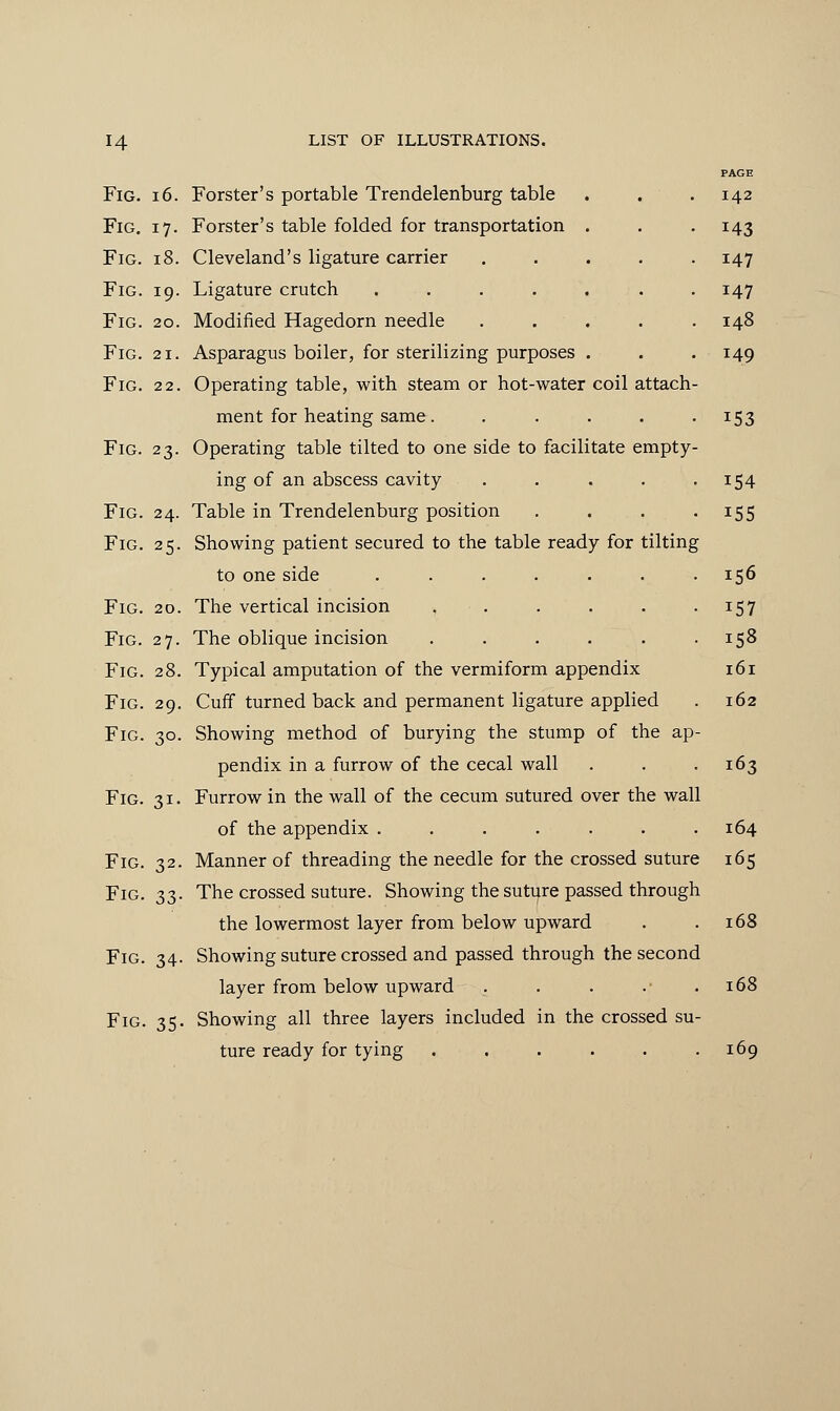 Fig. 32- Fig. 33- Fig. 34- Fig. 35- PAGE 142 U3 147 147 148 149 Fig. 16. Forster's portable Trendelenburg table Fig. 17. Forster's table folded for transportation . Fig. 18. Cleveland's ligature carrier .... Fig. 19. Ligature crutch ...... Fig. 20. Modified Hagedorn needle .... Fig. 21. Asparagus boiler, for sterilizing purposes . Fig. 22. Operating table, with steam or hot-water coil attach- ment for heating same. . . . . 153 Fig. 23. Operating table tilted to one side to facilitate empty- ing of an abscess cavity . . . . 154 Fig. 24. Table in Trendelenburg position . . . 155 Fig. 25. Showing patient secured to the table ready for tilting to one side ....... 156 Fig. 20. The vertical incision , . . . . 157 Fig. 27. The oblique incision . . . . . -158 Fig. 28. Typical amputation of the vermiform appendix 161 Fig. 29. Cuff turned back and permanent ligature applied . 162 Fig. 30. Showing method of burying the stump of the ap- pendix in a furrow of the cecal wall . . .163 Fig. 31. Furrow in the wall of the cecum sutured over the wall of the appendix . . . . . . .164 Manner of threading the needle for the crossed suture 165 The crossed suture. Showing the suture passed through the lowermost layer from below upward . .168 Showing suture crossed and passed through the second layer from below upward . . . . .168 Showing all three layers included in the crossed su- ture ready for tying . . . . . .169