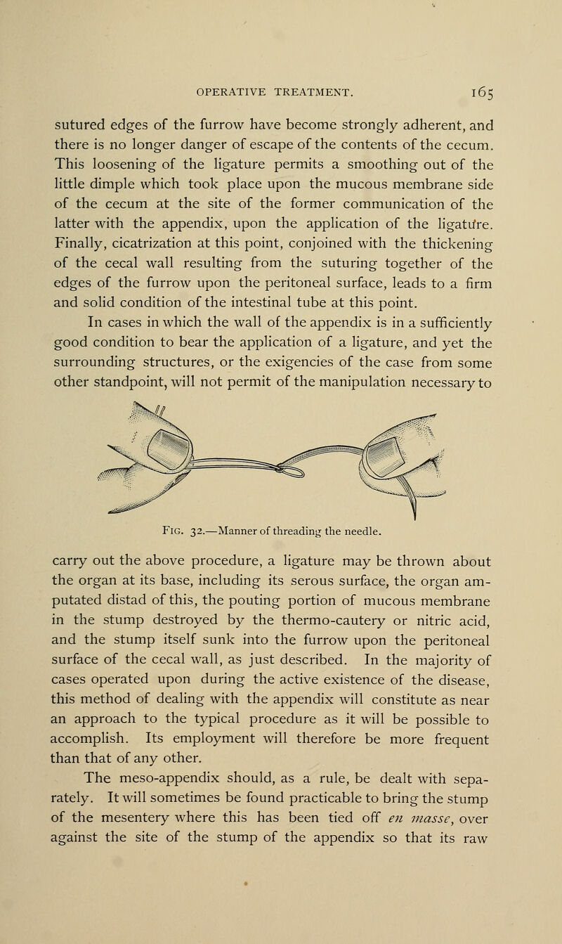 sutured edges of the furrow have become strongly adherent, and there is no longer danger of escape of the contents of the cecum. This loosening of the ligature permits a smoothing out of the little dimple which took place upon the mucous membrane side of the cecum at the site of the former communication of the latter with the appendix, upon the application of the ligature. Finally, cicatrization at this point, conjoined with the thickening of the cecal wall resulting from the suturing together of the edges of the furrow upon the peritoneal surface, leads to a firm and solid condition of the intestinal tube at this point. In cases in which the wall of the appendix is in a sufficiently good condition to bear the application of a ligature, and yet the surrounding structures, or the exigencies of the case from some other standpoint, will not permit of the manipulation necessary to Fig. 32.—Manner of threading the needle. carry out the above procedure, a ligature may be thrown about the organ at its base, including its serous surface, the organ am- putated distad of this, the pouting portion of mucous membrane in the stump destroyed by the thermo-cautery or nitric acid, and the stump itself sunk into the furrow upon the peritoneal surface of the cecal wall, as just described. In the majority of cases operated upon during the active existence of the disease, this method of dealing with the appendix will constitute as near an approach to the typical procedure as it will be possible to accomplish. Its employment will therefore be more frequent than that of any other. The meso-appendix should, as a rule, be dealt with sepa- rately. It will sometimes be found practicable to bring the stump of the mesentery where this has been tied off en masse, over against the site of the stump of the appendix so that its raw