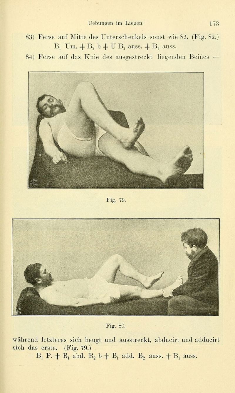 83) Ferse auf Mitte des Unterschenkels sonst wie 82. (Fig. 82.) B^ Um. =j= B2 b =)= U B2 auss. =j= Bj auss. 84) Ferse auf das Knie des ausgestreckt liegenden Beines — Fig. 79. Fig. 80. während letzteres sich beugt und ausstreckt, abducirt und adducirt sich das erste. (Fig. 79.) B^ P. 4^ B^ abd. B2 b =j= B^ add. B2 auss. 4^ B^ auss.