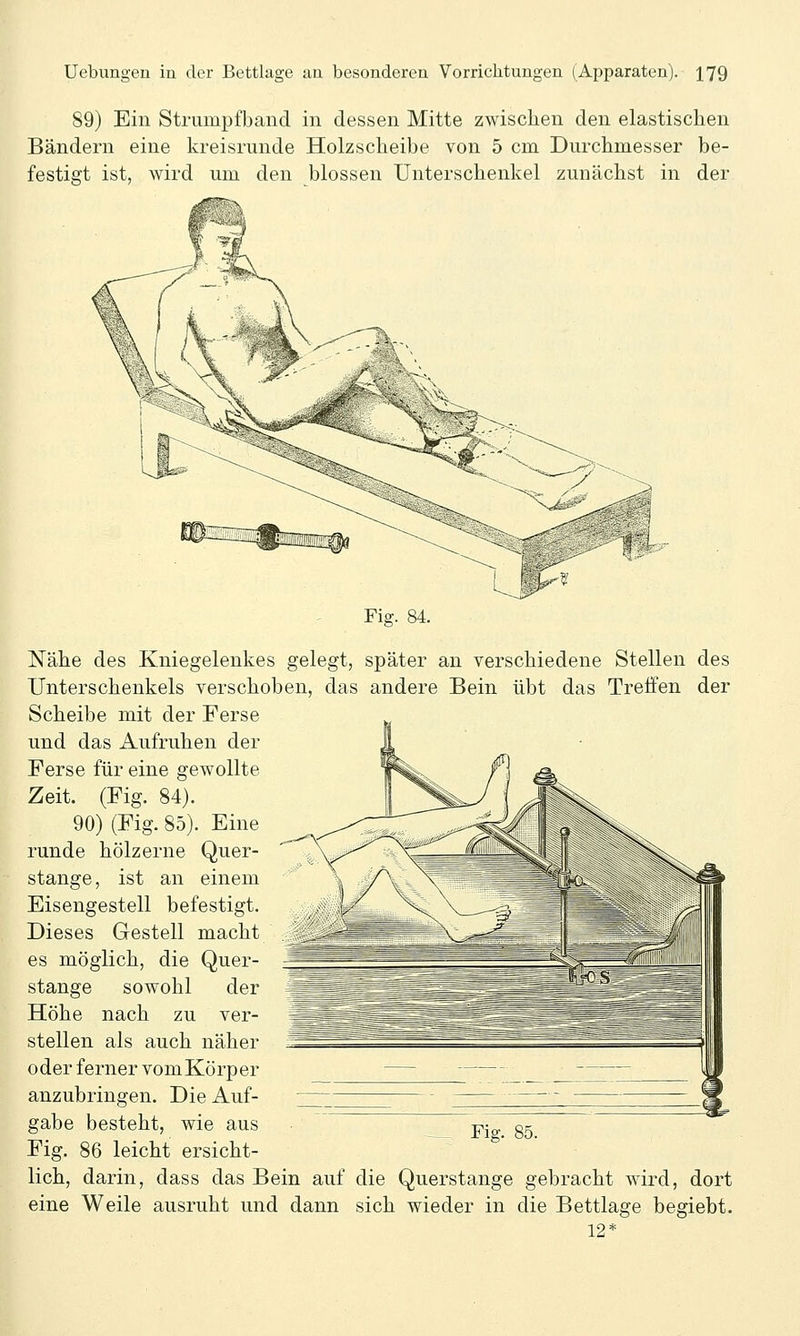 89) Ein Strumpfband in dessen Mitte zwischen den elastischen Bändern eine kreisrunde Holzscheibe von 5 cm Durchmesser be- festigt ist, wird um den blossen Unterschenkel zunächst in der des der Fig. 84. Nähe des Kniegelenkes gelegt, später an verschiedene Stellen Unterschenkels verschoben, das andere Bein übt das Treifen Scheibe mit der Ferse und das Aufruhen der Ferse für eine gewollte Zeit. (Fig. 84). 90) (Fig. 85). Eine runde hölzerne Quer- stange, ist an einem Eisengestell befestigt. Dieses Gestell macht es möglich, die Quer- stange sowohl der Höhe nach zu ver- stellen als auch näher oder ferner vomKörper anzubringen. Die Auf- gabe besteht, wie aus -p- gg Fig. 86 leicht ersicht- lich, darin, dass das Bein auf die Querstange gebracht wird, dort eine Weile ausruht und dann sich wieder in die Bettlage begiebt. 12*