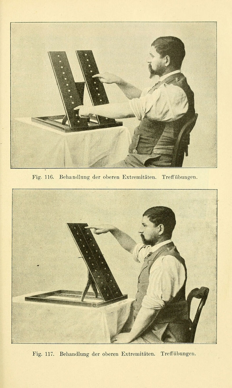 Fig. 117. Behandlung der oberen Extremitäten. TrefFübungen.