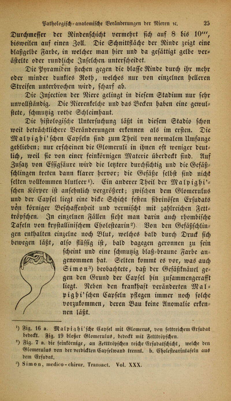 Surdjmejfer ber 9?tnbenfd)id)t vermehrt ftd; auf 8 6tö 10', bisweilen auf einen 3otf- ©te @^nittf(cid)e ber Dftnbe jeigt eine Magerte garbe, in welcher man frier unb ba gefättigt gelbe ver* äftelte ober runblicfye 3ttfetd)en unterfdjeibet. £)ie $h;ramiten ftedjen gegen bie blaffe 9tinbe burd; t£r mefjr ober minber bunffeä 9lofy, weites nur von einzelnen fetteren ©treffen unterbrochen wirb, fd;arf ah. 2)ie 3n][eetion ber Spiere gelingt in biefem ©tabium nur fe£r unvotlftänbig. Sie 9?ierenfeld;e unb ba£ 23ecfen Jjaben eine gewul* ftete, fd)tmi§ig votl>e ©d;f einbaut. £)ie lrifiotogifd;e Unterfudmng läßt in biefem ©tabio fcfyon \x>ät beträdjtlicbere 2kränberungen erfennen aU im erften. £)ie SÄatviglji'fdjen Gfapfeln finb jum £f)eit von normalem Umfange geblieben; nur erfreuten bie ©lomerult in ifmen oft weniger beut- \\ü), weil fte von einer feinförnigen 9Jfaterie ü&erbedt ftnb. Sluf 3ufaö von ©fftgfäure wirb bie teuere burd;ftc|)tig unb bie ©efäg- fdjttngen treten bann flarer Ijervor; bie ©efäße fetbft ftnb nid;t feiten vottfommen blutleer1). @tn anberer SCJjetl ber 2Walptgl;i1* f$en Körper ift anfeljnlid) vergrößert; jwifctyen bem ©lomeruluS unb ber dapfel liegt eine bide (Sfyityt feften ftbrinöfen (£rfubat$ von förntger 23efd;affenl;eit unb vermißt mit jaljlreidjen gett* tropften. 3n einzelnen gälten fte^t man barin au$ rl;ombifd;e Safein von fr*)ftattinifd;em ^oleftearin2). 23on ben ©efäßf^tin* gen enthalten einzelne no$ ©tut, wetdjeS balb burd; £)rud ftd; bewegen läßt, atfo flüfftg ift, balb bagegen geronnen ju fein fc^eint unb eine fd)mu$ig bfaß^braune garbe an^ genommen f>at. ©elten fommt eö vor, tva$ and) Simon3) beobachtete, baß ber ©efäßfnäuet ge- gen ben ©runb ber @apfel §in jufammengerajft liegt. Sfteben ben franffjaft veränberten WlaU pigf>i1fd)en @apfetn pflegen immer nod) fofcfje vorjufommen, beren Sau feine Anomalie erfen^ nen läßt. 1) $ig. 16 a. $Ralpic\$V\ä)t (Savfel mit (SHomeru*, fcott fettreichem (Srfnbat bebecft. gig. 19 btoßer ®(omeru(u$, bebetft mit Setttröpfc^en. 2) St9- 7 a. bie feinförnige, an Setttröpfcfyen reiche (Srfubatfcfyicfyt, welche beu (SHomernluS üon ber »erbicften (Sapfelroanb trennt, b. ßfyolejtearintafeht ans bem (Srfnbat. 3) Simon, medico-chirur. Transact. Vol. XXX.