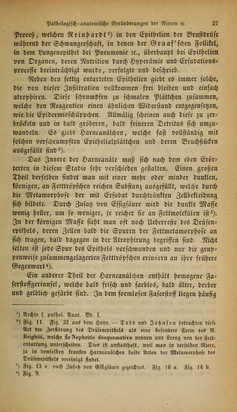 $roce§, wetzen ^einfjarbt1) in ben (£pitf>etien ber 33ruflbrüfe wäfnrenb ber @$roangerfd)aft, in benen ber ©raaf'fcben gottifef, in bem Sungenepttyel bei Pneumonie :c, überbauet ki ßrpitljetien *>on Organen, beren Antritten burd) £t)perämie unb (Sxfubationö* proceffe beeinträchtigt würbe, verfolgte unb betrieb. 9?eben ben fettig entarteten (Spitzelten giebt e6 immer fo($e, bie t>on biefer ^nftltratton sottfommen frei hUibtn unb einfach atropfuren. £)iefe fd;rumpfen ju fdjmaten $(ätt$en jufammen, welche ben 9?eagentien einen äfmtidjen Söiberftanb entgegenfeften, n>te bie (£pibermisfd)üppcfyen. SlUmäfig fdjeinen aud) biefe ju §er- brodeln unb in ba(b gröberen, balb feineren Detritus ftd) umju* wanbeln. @3 giebt £arncanä(d)en, wet$e faft ttottftänbig mit folgen t>erfd)rumpften (£pitt;e(tatptätt$en unb beren 25rud)ftütfen aufgefüllt ft'nb2). 2)a£ innere ber £>arncanäfe muß ftrf) nad) bem tbm (£ror* terten in biefem ©tabio fef)r tferfdueben gefiaften. Gnnen großen SEfjetl berfelben ftnbet man mit einer mefjr ober minber bunften, förnigen, an getttropfcfyen reichen ©ubftanj aufgefüllt, wefdje burd) bie 9)?etamorpf)ofe ber mit (Jrfubat burd;tränften 3ellbefletbung fid) bitbete. £)ur$ 3nfa§ son (Jfftgfäure wirb bie bunfle 9#affe wenig fetter, um fo weniger, je reicher fte an gettmolefüten ift3). 3n ber förnigen 9D?affe fielet man oft nod) Ueberrefte bes ©rufen* epitbeB, beren 3^en batb bie ©puren ber gettmetamorpfwfe an ffcf> tragen, balb bagegen in ber 2ltropf)irung begriffen ftnb. 9?id)t fetten ift jebe ©pur beö @pitf>et3 *>erfd)Wunben unb nur bie grup* penweife jufammengefagerten getttröpfcfyen erinnern an ifjre frühere ©egenwart4). ©in anberer JCJjetf ber £arncanätd;en enthalt homogene ga- ferftoffgerinnfef, welche batb frifd) unb färbtet, batb älter, berber unb getbtid) gefärbt ftnb. %n bem formlofen gaferftoff liegen fmuftg 1) 2ird>h> f. patycl 5tnat. 53b. I. 2) Sig- 11- gt9- 32 auö bem £arn. — £obb unb 3o(>nfon betrauten btefe 5lrt ber 3evftörung beS ^Drüfenet>itr)etö alö eine befonbere gorm t>e$ M. Brightii, welche fie Nephritis desquamativa nennen unb ftreng ücn ber gett- entartung, unterfcfyeiben. 2)ieö ift unftattfyaft, treu man in berfelben Sftiere, ja in bemfetben franfen £arncanäld)en beibe 9lrten ber Sfleiamorpfyofe be$ $)rüfenet>itfjel$ vereinigt ftnbet. *) gig. 13 a. na* 3ufa£ »on ©fftgfäure g,c§etfyiet. gig 16 a. gig. 14 b. 4) Sig. 9.