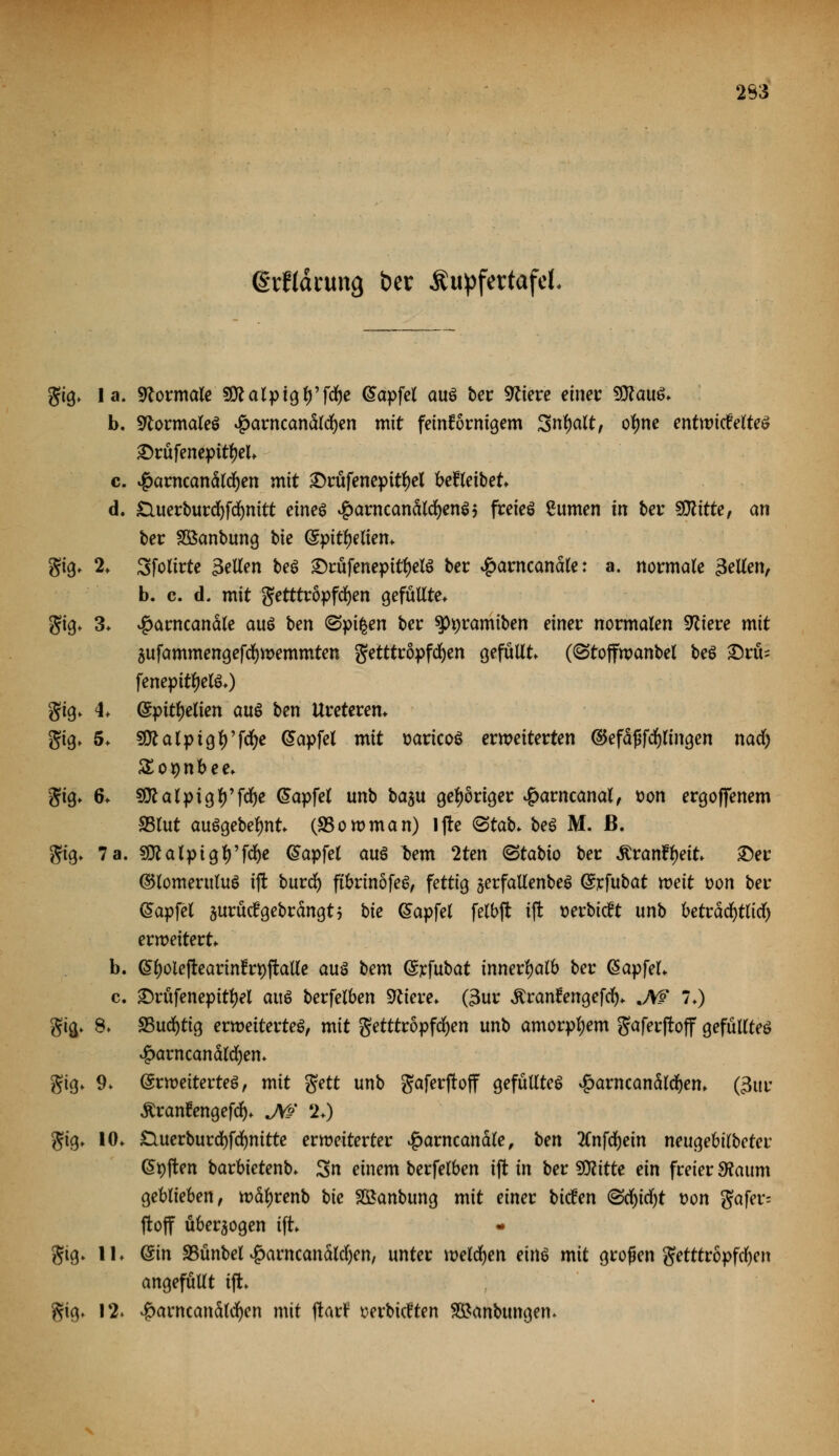 283 erftärimg ber Äu^fertafcl. gig* la. Normale SÜUlptglj'fdje Gapfel aus ber öftere einer SQfauS* b. Normales £arncanäld()en mit feinkörnigem 3nf)alt, otyne entwickeltes ^>rüfenepit^el* c. ^arncanälcfyen mit £)rüfenepitl)el betreibet d. &uerburd)fd)nitt eines ^arncanälcfyenS? freies £umen in ber SDtttte, an ber Sßanbung bie @pitf)elien* gig. 2> Sfolirte Seilen beS £)rüfenepitl)elS ber #arncanale: a. normale 3eUm, b. c. d. mit getttröpfcfyen gefüllte, gtg* 3* #arncanäle aus ben ^pi^en ber ^ramiben einer normalen Spiere mit 5ufammengefd)wemmten getttröpfdfjen gefüllt ((Stoffwanbel beS £)rfo fenepitljelS*) gig* <L (gpityelien aus ben Ureterem gig> 5* SDlalptgfy'fcfye (Sapfel mit sartcoS erweiterten ©efäf5fcf)lmgen nad) SEopnbee* gig* 6* Sftalptglf fdje @apfel unb baju gehöriger #arncanal, t>on ergoffenem 23lut ausgebest (SSowman) lftc ®tab. beS M. ß. gig* 7a. §Olalpigl)'f^e (Sapfel aus tem 2ten ©tabto ber Äranftyett £)er ©lomeruluS tjt burdf) ftbrmöfeS, fettig §erfatlenbeS ©cfubat weit t>on ber @apfel aurücfgebrängt5 bie (Sapfel felbjt iffc tterbtcrt unb beträcfytlitf) erweitert b. @l)oiejtearinfrt)ftalle aus bem (Srfubat innerhalb ber @apfel> c. £)rüfenepitljel aus berfelben SKiere* (3ur Ärantengefcfy* JW 7/) gig> 8* SBucfytig erweitertes, mit getttröpfcfyen unb amorphem gaferftoff gefülltes £arncanäldf)em gig* 9* Erweitertes, mit gett unb gaferftoff gefülltes ^arncandld^en. (3ttr Äranfengefdf)* JW 20 gig, 10* £luerburdf)f(^nitte erweiterter #arncanäle, ben 2Cnfdjein neugebilbcter Giften barbietenb* 3n einem berfelben ifl in ber Glitte ein freier diaum geblieben, wctyrenb bie SBanbung mit einer bicüen (Scfyicfyt t>on gafer= ftoff überwogen ifh - gig> 11. (Sin SBünbel #arncanalcl)en, unter welken eins mit großen getttropfcljen angefüllt tjt gig» 12. #arncanäld(jen mit ftar? serbkt'ten 2£anbungem