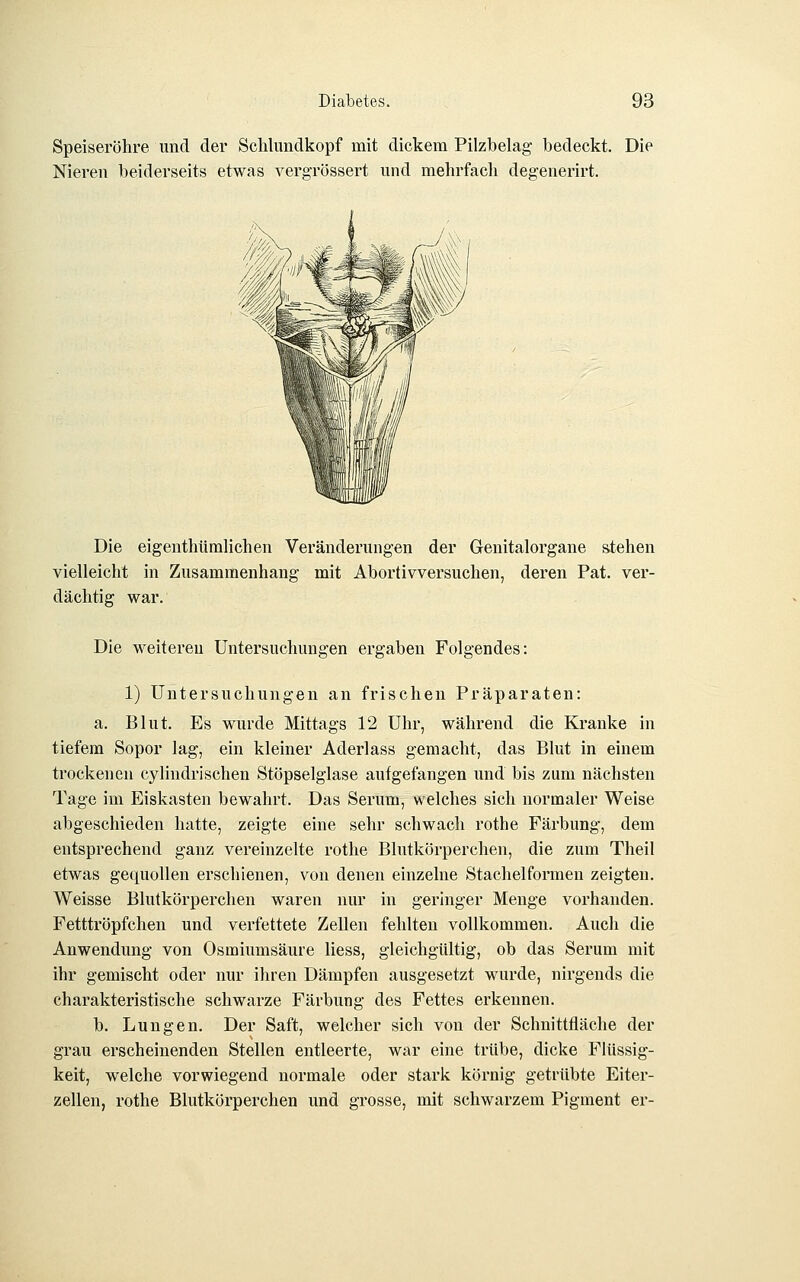 Speiseröhre und der Sclilundkopf mit dickem Pilzbelag- bedeckt. Die Nieren beiderseits etwas vergrössert und mehrfach degenerirt. Die eigenthtimlichen Veränderungen der Genitalorgane stehen vielleicht in Zusammenhang mit Abortivversuchen, deren Pat. ver- dächtig war. Die weitereu Untersuchungen ergaben Folgendes: 1) Untersuchungen an frischen Präparaten: a. Blut. Es wurde Mittags 12 Uhr, während die Kranke in tiefem Sopor lag, ein kleiner Aderlass gemacht, das Blut in einem trockenen cylindrischen Stöpselglase aufgefangen und bis zum nächsten Tage im Eiskasten bewahrt. Das Serum, welches sich normaler Weise abgeschieden hatte, zeigte eine sehr schwacli rothe Färbung, dem entsprechend ganz vereinzelte rothe Blutkörperchen, die zum Theil etwas gequollen erschienen, von denen einzelne Stachelformen zeigten. Weisse Blutkörperchen waren nur in geringer Menge vorhanden. Fetttröpfchen und verfettete Zellen fehlten vollkommen. Auch die Anwendung von Osmiumsäure liess, gleichgültig, ob das Serum mit ihr gemischt oder nur ihren Dämpfen ausgesetzt wurde, nirgends die charakteristische schwarze Färbung des Fettes erkennen. b. Lungen. Der Saft, welcher sich von der Schnittfläche der grau erscheinenden Stellen entleerte, war eine trübe, dicke Flüssig- keit, welche vorwiegend normale oder stark körnig getrübte Eiter- zellen, rothe Blutkörperchen und grosse, mit schwarzem Pigment er-