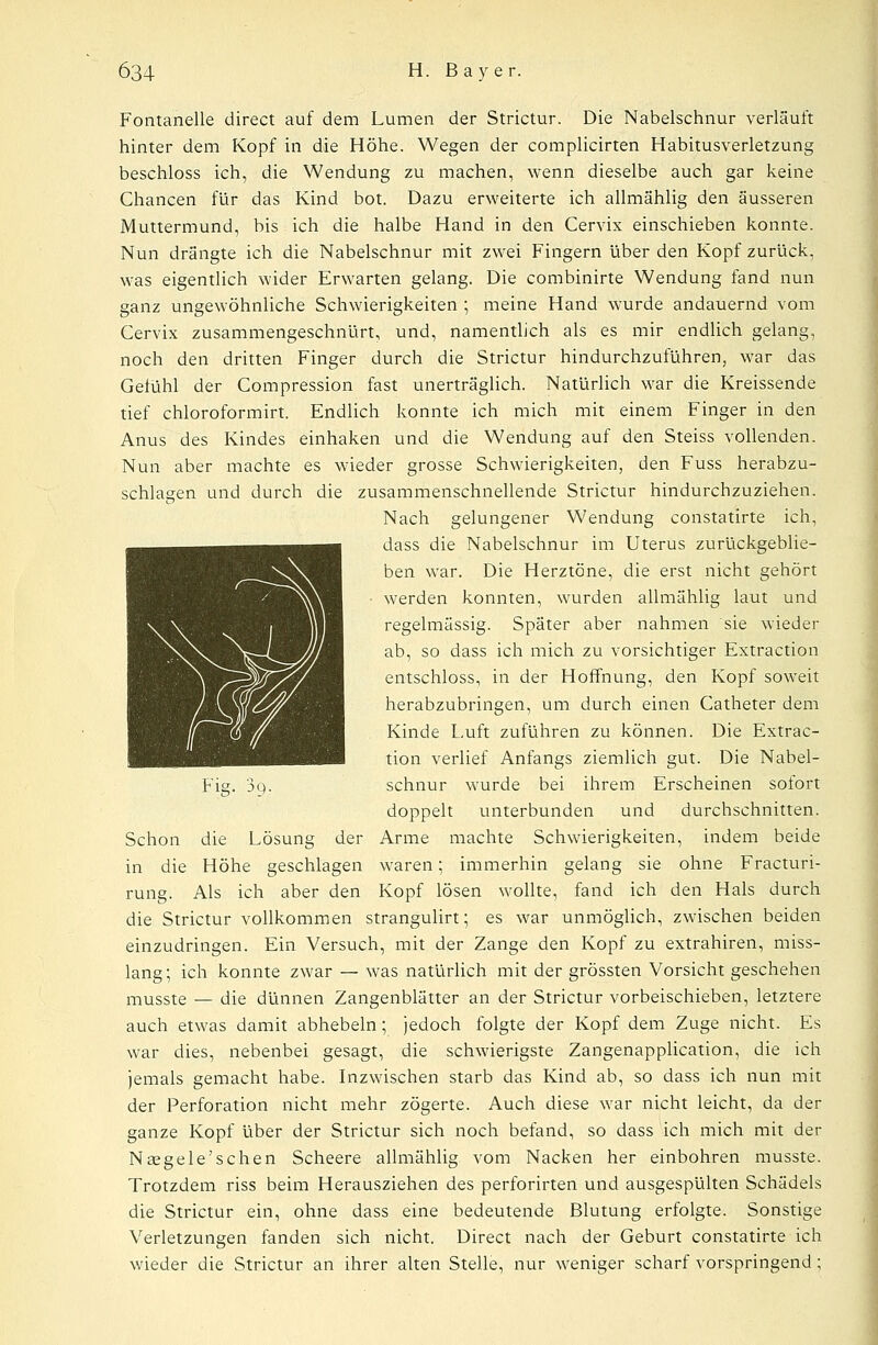 Fontanelle direct auf dem Lumen der Strictur. Die Nabelschnur verläuft hinter dem Kopf in die Höhe. Wegen der complicirten Habitusverletzung beschloss ich, die Wendung zu machen, wenn dieselbe auch gar keine Chancen für das Kind bot. Dazu erweiterte ich allmählig den äusseren Muttermund, bis ich die halbe Hand in den Cervix einschieben konnte. Nun drängte ich die Nabelschnur mit zwei Fingern über den Kopf zurück, was eigentlich wider Erwarten gelang. Die combinirte Wendung fand nun ganz ungewöhnliche Schwierigkeiten ; meine Hand wurde andauernd vom Cervix zusammengeschnürt, und, namentlich als es mir endlich gelang, noch den dritten Finger durch die Strictur hindurchzuführen, war das Gefühl der Compression fast unerträglich. Natürlich war die Kreissende tief chloroformirt. Endlich konnte ich mich mit einem Finger in den Anus des Kindes einhaken und die Wendung auf den Steiss vollenden. Nun aber machte es wieder grosse Schwierigkeiten, den Fuss herabzu- schlagen und durch die zusammenschnellende Strictur hindurchzuziehen. Nach gelungener Wendung constatirte ich, dass die Nabelschnur im Uterus zurückgeblie- ben war. Die Herztöne, die erst nicht gehört • werden konnten, wurden allmählig laut und regelmässig. Später aber nahmen sie wieder ab, so dass ich mich zu vorsichtiger Extraction entschloss, in der Hoffnung, den Kopf soweit herabzubringen, um durch einen Catheter dem Kinde Euft zuführen zu können. Die Extrac- tion verlief Anfangs ziemlich gut. Die Nabel- Fig. 'ig. schnür wurde bei ihrem Erscheinen sofort doppelt unterbunden und durchschnitten. Schon die Lösung der Arme machte Schwierigkeiten, indem beide in die Höhe geschlagen waren; immerhin gelang sie ohne Fracturi- rung. Als ich aber den Kopf lösen wollte, fand ich den Hals durch die Strictur vollkommen strangulirt; es war unmöglich, zwischen beiden einzudringen. Ein Versuch, mit der Zange den Kopf zu extrahiren, miss- lang; ich konnte zwar — was natürlich mit der grössten Vorsicht geschehen musste — die dünnen Zangenblätter an der Strictur vorbeischieben, letztere auch etwas damit abhebein; jedoch folgte der Kopf dem Zuge nicht. Es war dies, nebenbei gesagt, die schwierigste Zangenapplication, die ich jemals gemacht habe. Inzwischen starb das Kind ab, so dass ich nun mit der Perforation nicht mehr zögerte. Auch diese war nicht leicht, da der ganze Kopf über der Strictur sich noch befand, so dass ich mich mit der Neegele'sehen Scheere allmählig vom Nacken her einbohren musste. Trotzdem riss beim Herausziehen des perforirten und ausgespülten Schädels die Strictur ein, ohne dass eine bedeutende Blutung erfolgte. Sonstige Verletzungen fanden sich nicht. Direct nach der Geburt constatirte ich wieder die Strictur an ihrer alten Stelle, nur weniger scharf vorspringend;