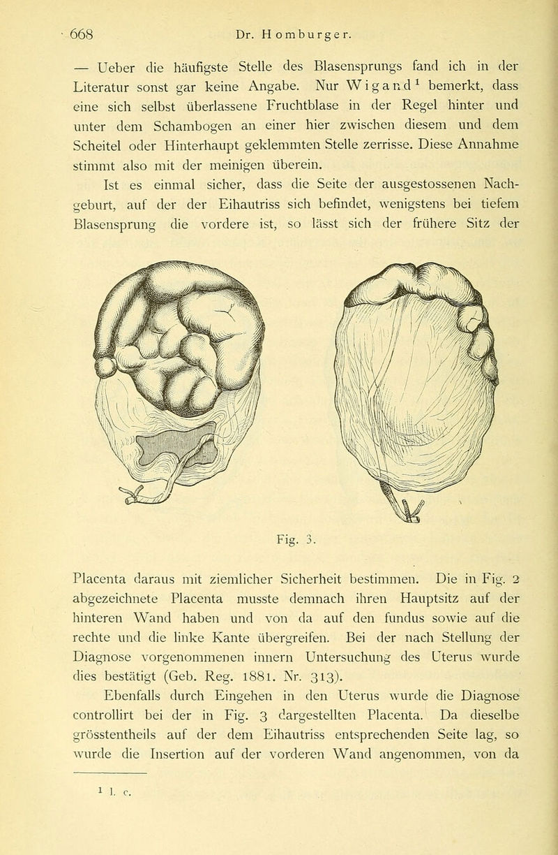 — Ueber die häufigste Stelle des Blasensprungs fand ich in der Literatur sonst gar keine Angabe. Nur W i g a n d ? bemerkt, dass eine sich selbst überlassene Fruchtblase in der Regel hinter und unter dem Schambogen an einer hier zwischen diesem und dem Scheitel oder Hinterhaupt geklemmten Stelle zerrisse. Diese Annahme stimmt also mit der meinigen überein. Ist es einmal sicher, dass die Seite der ausgestossenen Nach- geburt, auf der der Eihautriss sich befindet, wenigstens bei tiefem Blasensprung die vordere ist, so lässt sich der frühere Sitz der Fü Placenta daraus mit ziemlicher Sicherheit bestimmen. Die in Fig. 2 abgezeichnete Placenta musste demnach ihren Hauptsitz auf der hinteren Wand haben und von da auf den fundus sowie auf die rechte und die linke Kante übergreifen. Bei der nach Stellung der Diagnose vorgenommenen innern Untersuchung des Uterus wurde dies bestätigt (Geb. Reg. 1881. Nr. 313). Ebenfalls durch Eingehen in den Uterus wurde die Diagnose controllirt bei der in Fig. 3 dargestellten Placenta. Da dieselbe grösstentheils auf der dem Eihautriss entsprechenden Seite lag, so wurde die Insertion auf der vorderen Wand angenommen, von da 1 I. c.