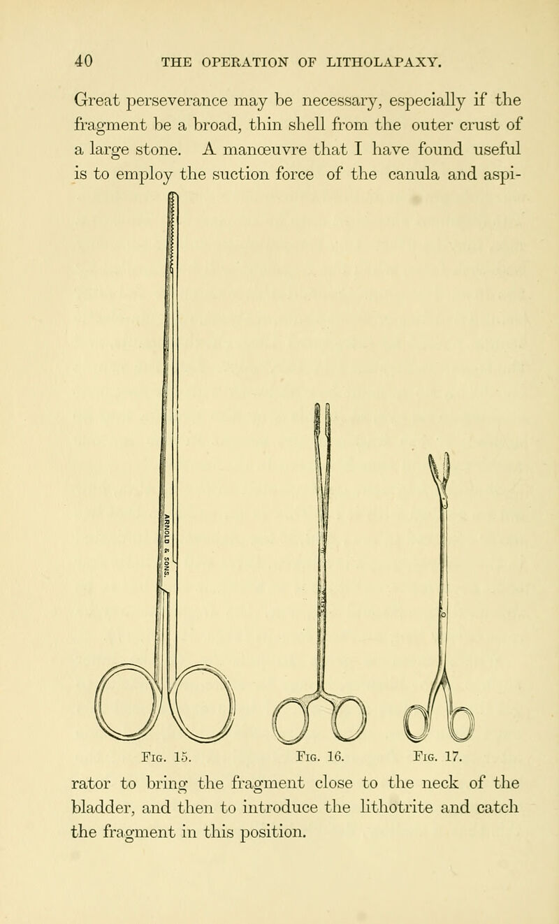 Great perseverance may be necessary, especially if the fragment be a broad, thin shell from the outer crust of a large stone. A manoeuvre that I have found useful is to employ the suction force of the canula and aspi- Fig. 15. Fig. 16. Fig. 17. rator to bring the fragment close to the neck of the bladder, and then to introduce the lithotrite and catch the fragment in this position.