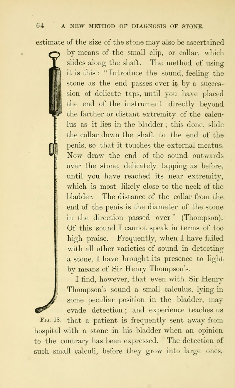 estimate of the size of the stone may also be ascertained by means of the small clip, or collar, which slides along the shaft. The method of using it is this :  Introduce the sound, feeling the stone as the end passes over it by a succes- sion of delicate taps, until you have placed the end of the instrument directly beyond the farther or distant extremity of the calcu- lus as it lies in the bladder; this done, slide the collar down the shaft to the end of the penis, so that it touches the external meatus. Now draw the end of the sound outwards over the stone, delicately tapping as before, until you have reached its near extremity, which is most likely close to the neck of the bladder. The distance of the collar from the end of the penis is the diameter of the stone in the direction passed over (Thompson). Of this sound I cannot speak in terms of too high praise. Frequently, when I have failed with all other varieties of sound in detecting a stone, I have brought its presence to light by means of Sir Henry Thompson's. I find, however, that even with Sir Henry Thompson's sound a small calculus, lying in some peculiar position in the bladder, may evade detection ; and experience teaches us Fig. 18. that a patient is frequently sent away from hospital with a stone in his bladder when an opinion to the contrary has been expressed. The detection of such small calculi, before they grow into large ones,