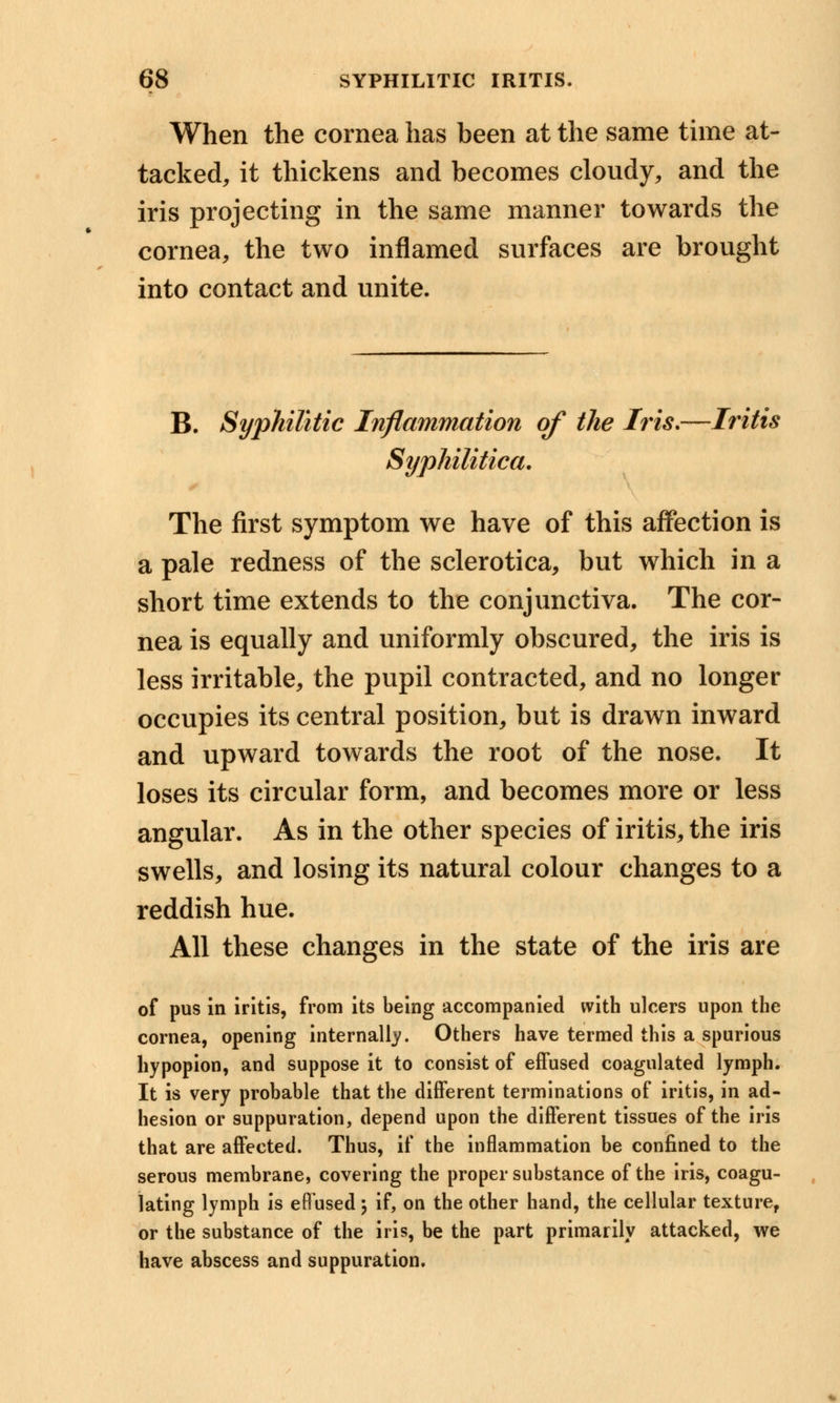 When the cornea has been at the same time at- tacked, it thickens and becomes cloudy, and the iris projecting in the same manner towards the cornea, the two inflamed surfaces are brought into contact and unite. B. Syphilitic Inflammation of the his.—Iritis Syphilitica. The first symptom we have of this affection is a pale redness of the sclerotica, but which in a short time extends to the conjunctiva. The cor- nea is equally and uniformly obscured, the iris is less irritable, the pupil contracted, and no longer occupies its central position, but is drawn inward and upward towards the root of the nose. It loses its circular form, and becomes more or less angular. As in the other species of iritis, the iris swells, and losing its natural colour changes to a reddish hue. All these changes in the state of the iris are of pus in iritis, from its being accompanied with ulcers upon the cornea, opening internally. Others have termed this a spurious hypopion, and suppose it to consist of effused coagulated lymph. It is very probable that the different terminations of iritis, in ad- hesion or suppuration, depend upon the different tissues of the iris that are affected. Thus, if the inflammation be confined to the serous membrane, covering the proper substance of the iris, coagu- lating lymph is effused \ if, on the other hand, the cellular texture, or the substance of the iris, be the part primarily attacked, we have abscess and suppuration.