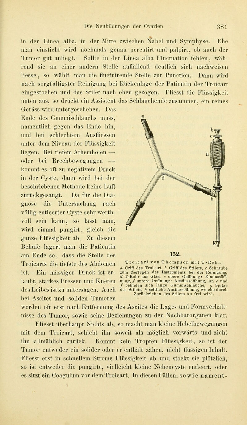 in der Linea alba, in der Mitte zwischen Nabel und Symphyse. Ehe man einsticht wird nochmals genau percutirt und palpirt, ob auch der Tumor gut anliegt. Sollte in der Linea alba Fluctuation fehlen, wäh- rend sie an einer andern Stelle auffallend deutlich sich nachweisen Hesse, so wählt man die fluctuirende Stelle zur Punctum. Dann wird nach sorgfältigster Reinigung bei Rückenlage der Patientin der Troicart eingestochen und das Stilet nach oben gezogen. Fliesst die Flüssigkeit unten aus, so drückt ein Assistent das Schlauchende zusammen, ein reines Gefäss wird untergeschoben. Das Ende des Gummischlauchs muss, namentlich gegen das Ende hin, und bei schlechtem Ausfliessen unter dem Niveau der Flüssigkeit liegen. Bei tiefem Athemholen — oder bei Brechbewegungen — kommt es oft zu negativem Druck in der Cyste, dann wird bei der beschriebenen Methode keine Luft zurückgesaugt. Da für die Dia- gnose die Untersuchung nach völlig entleerter Cyste sehr werth- voll sein kann, so lässt man, wird einmal pungirt, gleich die ganze Flüssigkeit ab. Zu diesem Behufe lagert man die Patientin am Ende so, dass die Stelle des Troicarts die tiefste des Abdomen ist. Ein massiger Druck ist er- laubt, starkes Pressen und Kneten 152. Troicart von Thompson mit T-Rohr. a Griff des Troicart, b Griff des Stilets, c Schraube zum Zerlegen des Instruments bei der Reinigung, d T-Rohr aus Glas, e obere Oeffnung: Einflussö'ff- nung, / untere Oeffnung: Ausflussöffnung, an e und / befinden sich lange Gummischläuche, g Spitze des Leibes ist ZU Untersagen. Auch des Stilets, h seitliche Ausflussöfinung, welche durch Zurückziehen des Stilets bg frei wird. bei Ascites und soliden Tumoren werden oft erst nach Entfernung des Ascites die Lage- und Formverhält- nisse des Tumor, sowie seine Beziehungen zu den Nachbarorganen klar. Fliesst überhaupt Nichts ab, so macht man kleine Hebelbewegungen mit dem Troicart, schiebt ihn soweit als möglich vorwärts und zieht ihn allmählich zurück. Kommt kein Tropfen Flüssigkeit, so ist der Tumor entweder ein solider oder er enthält zähen, nicht flüssigen Inhalt. Fliesst erst in schnellem Strome Flüssigkeit ab und stockt sie plötzlich, so ist entweder die pungirte, vielleicht kleine Nebencyste entleert, oder es sitzt ein Coagulum vor dem Troicart. In diesen Fällen, sowie uameiit-