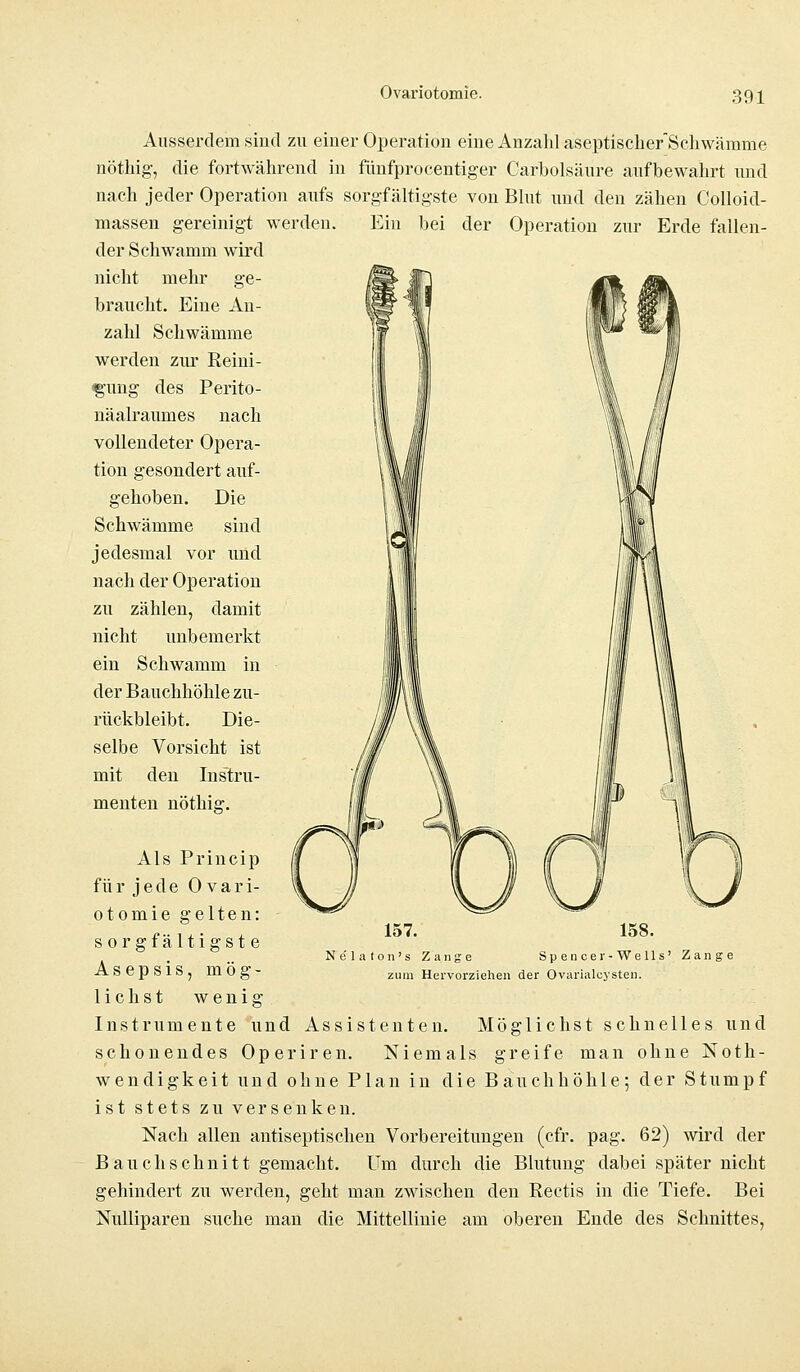 Ausserdem sind zu einer Operation eine Anzahl aseptischer Schwämme nöthig, die fortwährend in fünfprocentiger Carbolsäure aufbewahrt und nach jeder Operation aufs sorgfältigste von Blut und den zähen Colloid- massen gereinigt werden. Ein bei der Operation zur Erde fallen- der Schwamm wird nicht mehr ge- braucht. Eine An- zahl Schwämme werden zur Reini- gung des Perito- näalraumes nach vollendeter Opera- tion gesondert auf- gehoben. Die Schwämme sind jedesmal vor und nach der Operation zu zählen, damit nicht unbemerkt ein Schwamm in der Bauchhöhle zu- rückbleibt. Die- selbe Vorsicht ist mit den Instru- menten nöthig. Als Princip für jede 0 vari- otomie gelten: sorgfältigst e Asepsis, mög- lichst wenig Instrumente und Assistenten. Möglichst schnelles und schonendes Operiren. Niemals greife man ohne Not- wendigkeit und ohne Plan in die Bauchhöhle; der Stumpf ist stets zu versenken. Nach allen antiseptischen Vorbereitungen (cfr. pag. 62) wird der Bauchschnitt gemacht. Um durch die Blutung dabei später nicht gehindert zu werden, geht man zwischen den Rectis in die Tiefe. Bei Nulliparen suche man die Mittellinie am oberen Ende des Schnittes, 157. Nelaton's Zange zum Hervorziehen der Ovarialcysten. 158. Spencer-Wells' Zange