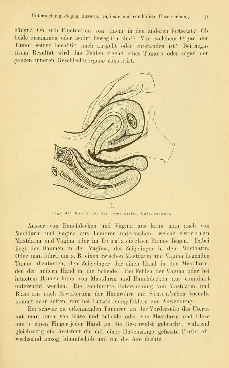 hängt? Ob sich Fluctuation von einem in den anderen fortsetzt? Ob beide zusammen oder isolirt beweglich sind? Von welchem Organ der Tumor seiner Localität nach ausgeht oder entstanden ist? Bei nega- tivem Resultat wird das Fehlen irgend eines Tumors oder sogar der ganzen inneren Geschlechtsorgane constatirt. Lage der Hände bei der combinirten Untersuchung. Ausser von Bauchdecken und Vagina aus kann man auch von Mastdarm und Vagina aus Tumoren untersuchen, welche zwischen Mastdarm und Vagina oder im D ougla sischen Räume liegen. Dabei liegt der Daumen in der Vagina, der Zeigefinger in dem Mastdarm. Oder man führt, um z. B. einen zwischen Mastdarm und Vagina liegenden Tumor abzutasten, den Zeigefinger der einen Hand in den Mastdarm, den der andern Hand in die Scheide. Bei Fehlen der Vagina oder bei intactem Hymen kann von Mastdarm und Bauchdecken aus combinirt untersucht werden. Die combinirte Untersuchung von Mastdarm und Blase aus nach Erweiterung der Harnröhre mit Simon'sehen Speculis kommt sehr selten, nur bei Entwickelungsfehlern zur Anwendung. Bei schwer zu erkennenden Tumoren an der Vorderseite des Uterus hat man auch von Blase und Scheide oder von Mastdarm und Blase aus je einen Finger jeder Hand an die Geschwulst gebracht, während gleichzeitig ein Assistent die mit einer Hakenzange gefasste Portio ab- wechselnd anzog, hinaufschob und um die Axe drehte.