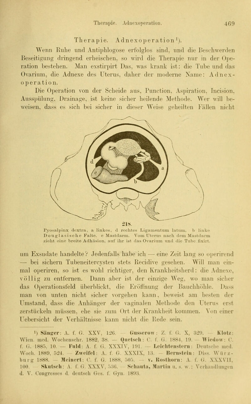 Therapie. A d n e x o p e r a t i o n ^). Wenn Ruhe und Antiphlogose erfolglos sind, und die lleschAverden Beseitigung dringend erheischen, so wird die Therapie nur in der Ope- ration bestehen. Man exstirpirt Das, was krank ist: die Tube und das Ovarium, die Adnexe des Uterus, daher der moderne Name: Adnex- operation. Die Operation von der Scheide aus, Function, Aspiration, Incision, Ausspülung, Drainage, ist keine sicher heilende Methode. Wer will be- weisen, dass es sich bei sicher in dieser Weise geheilten Fällen nicht 21». l'yo.saljainx dt'xtra, a linkes, d rechtes Ligamentum latum. b linke D o u g 1 a s i s oh e Falte, e Mastdarm. Vom Uterus nach dem Mastdarm zieht eine breite Adhäsion, auf ihr ist das Ovarium und die Tube fixirt. um Exsudate handelte? Jedenfalls habe ich — eine Zeit lang so operirend — bei sichern Tubeneitercysten stets Recidive gesehen. Will man ein- mal o[)eriren, so ist es wohl richtiger, den Krankheitsherd: die Adnexe, völlig zu entfernen. Dann aber ist der einzige Weg. wo man sicher das Operationsfeld überblickt, die Eröffnung der Bauchhöhle. Dass man von unten nicht sicher vorgehen kann, beweist am besten der Umstand, dass die Anhänger der vaginalen Methode den Uterus erst zerstückeln müssen, ehe sie zum Ort der Krankheit kommen, ^^m einer Uebersicht der Verhältnisse kann nicht die Rede sein. 1) Sänjjer: A. f. G. XXV, li'ii. (Jusscrow : /. f. C. X, Wien. med. Woclienschr. 1882, 3.S. - (Quetsch: (,'. W C. ISSI. 1!). f. (1. 188.). 10. — Fiild: A. f. (i. XXXIV, 1!)1. — LcicliUMisIcni: Wocli. 18H9, 524. ZuriCcI: A. f. G. XXXIX, IH. Hcnisloiii bui-g 1888. - 3I('incrt: ('. f. Ü. 1888, .■)().>. - v. Kosthoni: A. 100. Skiilsch: \. f. G. XXXV, 5;{6. Schaiitn, HI:ir1iii u. s. w : d. V. Congresses d. deutsch Ges. f. Gyn. 18i).'i. Ol».). KIol/: »icdon : C. Deutsclic med. : Diss. Wiirz- f. G. XXXVII. N'erliaiidlniigoü