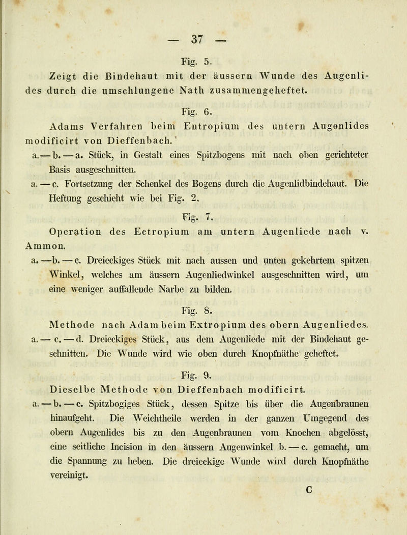 Fig. 5. Zeigt die Bindehaut mit der äussern Wunde des Augenli- des durch die umschlungene Nath zusammengeheftet. Fig. 6. Adams Verfahren beim Entropium des untern Augenlides modificirt von Dieffenbach.' a.—b. — a. Stück, in Gestalt eines Spitzbogens mit nach oben gerichteter Basis ausgesclinitten. a. — c. Fortsetzung der Schenkel des Bogens durch die Augenlidbindehaut. Die HeftuDg geschieht wie bei Fig. 2. Fig. 7. Operation des Ectropium am untern Augenliede nach v. Amnion, a. —b. — c. Dreieckiges Stück mit nach aussen und unten gekehrtem spitzen Winkel, welches am äussern Augenliedwinkel ausgesclmitten wird, um eine weniger auffallende Narbe zu bilden. Fig. 8. Methode nach Adam beim Extropium des obern Augenliedes, a.— c.—d. Dreieckiges Stück, aus dem Augenliede mit der Bindehaut ge- sclmitten. Die Wunde wird wie oben durch Knopfnäthe geheftet. Fig. 9. Dieselbe Methode von Dieffenbach modificirt. a. — b. — c. Spitzbogiges Stück, dessen Spitze bis über die Augenbraunen hinaufgeht. Die Weichtheile werden in der ganzen Umgegend des obern Augenlides bis zu den Augenbraunen vom Knochen abgelösst, eine seitliche Incision in den äussern Augenwinkel b. — c. gemacht, um die Spannung zu heben. Die dreieckige Wunde wird durch Knopfnäthe