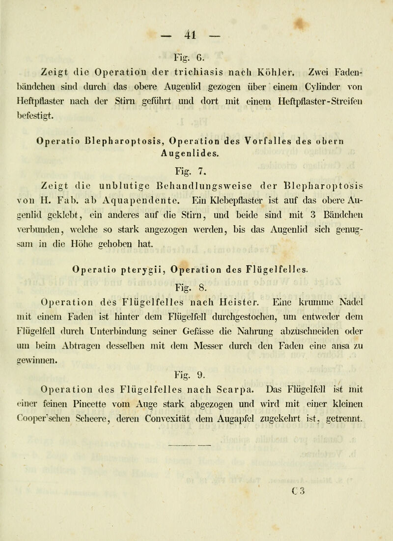 Fig. 6. Zeigt die Operation der tricliiasis nach Köhler. Zwei Faden- l)ändcheu sind durch das obere AugenUd gezogen über einem Cylinder von Heftpflaster nach der Stirn geführt und dort mit einem Heftpflaster-Streifen befestigt. Operatio Blepharoptosis, Operation des VorfaHes des obern Augenlides. Fig. 7. Zeigt die unblutige Behandlungsweise der Blepharoptosis von H. Fab. ab Aquapendente. Ein Klebepflaster ist auf das obere Au- genlid geklebt, ein anderes auf die Stirn, und beide sind mit 3 Bändchen verl)unden, welche so stark angezogen werden, bis das Augenlid sich genug- sam in die Höhe gehoben hat. Operatio pterygii, Operation des Flügelfelles. Fig. 8. Operation des Flügelfelles nach Heister. Eine krumme Nadel mit einem Faden ist hinter dem Flügelfell durchgestochen, um entweder dem Flügelfell durch Unterbindung seiner Gefässe die Nahrung abzuschneiden oder um beim Abtragen desselben mit dem Messer durch den Faden eine ansa zu ge\vinnen. Fig. 9. Operation des Flügelfelles nach Scarpa. Das Flügelfell ist mit einer feinen Pincette vom Auge stark abgezogen und wird mit einer kleinen Cooperseilen Scheere, deren Convexität dem Augapfel zugekehrt ist, getrennt. C3