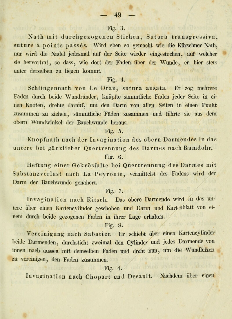 Fig. 3. Nath mit durchgezogenen Stichen, Sutura transgressiva, suture ä points passes. Wird eben so gemacht wie die Kürschner Nath, nur wird die Nadel jedesmal auf der Seite wieder eingestochen, auf welcher sie hervortrat, so dass, wie dort der Faden über der Wunde, er hier stets unter derselben zu liegen kommt. Fig. 4. Schlingennath von Le Dran, sutura ansata. Er zog mehrere Faden durch beide Wundränder, knüpfte sämmtliche Faden jeder Seite in ei- nen Knoten, drehte darauf, um den Darm von allen Seiten in einen Punkt zusammen zu ziehen, sämmtliche Fäden zusammen und fülnrte sie aus dem obern WmKhvinkel der Bauchwunde heraus. Fig. 5. Knopfuath nach der Invagination des obern Darmendes in das untere bei gänzlicher Quertrennung des Darmes nach Ramdohr. Fig. 6. Heftung einer Gekrösfalte bei Quertrennung des Darmes mit Substanzverlust nach La Peyronie, vermittelst des Fadens wird der Darm der Bauchwunde genähert. Fig. 7. Invagination nach Ritsch. Das obere Darmende wird in das un- tere über einen Kartencylinder geschoben und Darm und Kartenblatt von ei- nem durch beide gezogenen Faden in ihrer Lage erhalten. Fig. 8. Vereinigung nach Sabatier. Er schiebt üter einen Kartencylinder beide Darmenden, durchsticht zweimal den Cylinder und jedes Darmende von innen nach aussen mit demselben Faden und dreht nun, um die Wundlefzen zu vereinigen, den Faden zusammen. Fig. 4. Invagination nach Chopart und Desault. Nachdem über einen