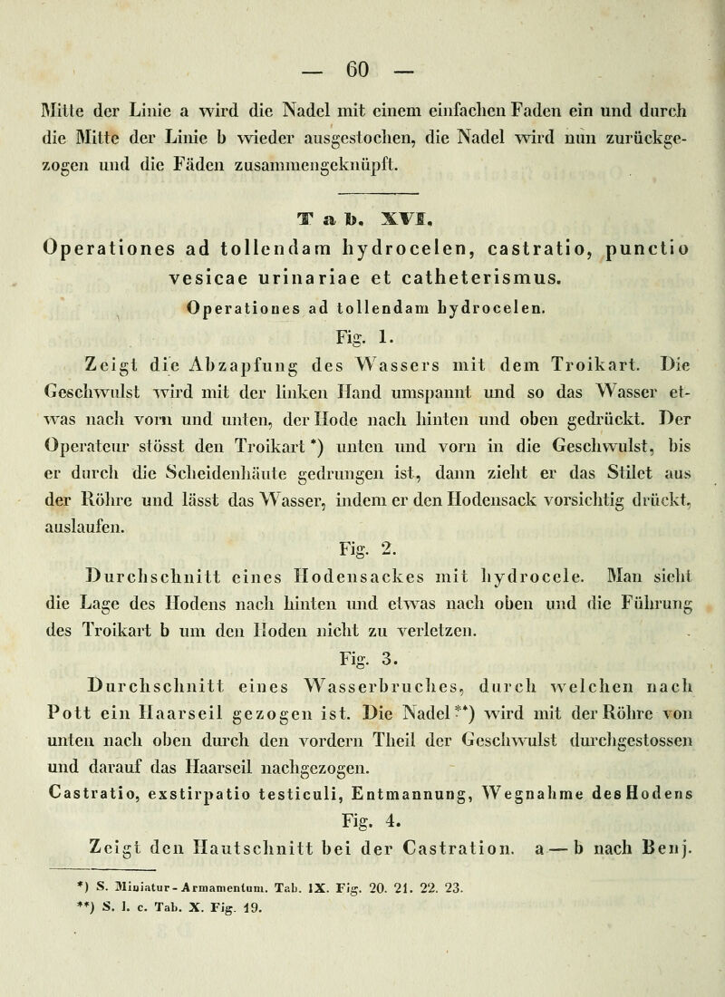 Mitte der Linie a wird die Nadel mit einem einfachen Faden ein und durch die Mitte der Linie b wieder ausgestochen, die Nadel wird nun zurückge- zogen und die Fäden zusammengeknüpft. Tal), XVI, Operationes ad tollcndam hydrocelen, castratio, punctlo vesicae urinariae et catheterismus. Operationes ad tollendam hydrocelen. Fig. 1. Zeigt die Abzapfung des Wassers mit dem Troikart. Die Geschwulst Tvird mit der linken Hand umspannt und so das Wasser et- Tvas nach vorn und unten, derHode nach hinten und oben gedrückt. Der Operateur stösst den Troikart *) unten und vorn in die Gesellwulst, bis er durch die Scheidenhäute gedrungen ist, dann zieht er das Stilet aus der Röhre und lässt das Wasser, indem er den Hodensack vorsichtig drückt, auslaufen. Fig. 2. Durchschnitt eines Hodensackes mit hydrocele. Man sieht die Lage des Hodens nach hinten und etwas nach oben und die Führung des Troikart b um den Hoden nicht zu verletzen. Fig. 3. Durchschnitt eines Wasserbruches, durch welchen nach Pott ein Haar seil gezogen ist. Die Nadel**) wird mit der Röhre von unten nach oben durch den vordem Theil der Geschvs^ulst durchgestossen und darauf das Haarseil nachgezogen. Castratio, exstirpatio testiculi, Entmannung, Wegnahme desHodens Fig. 4. Zeigt den Hautschnitt bei der Castration. a —b nach Benj. *) S. Miuiatur-Armamentum, Tab. IX. FJg. 20. 21. 22. 23. **) S. 1. c. Tab. X. Fig. d9.