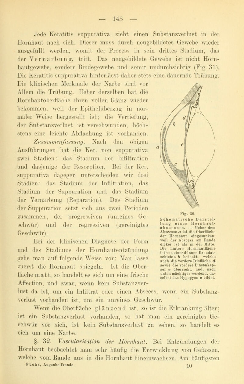 Jede Keratitis suppurativa zieht einen Substanzverlust in der Hornhaut nach sich. Dieser muss durch neugebildetes Gewebe wieder ausgefüllt werden, womit der Process in sein drittes Stadium, das der Vernarbung, tritt. Das neugebildete Gewebe ist nicht Horn- hautgewebe, sondern Bindegewebe und somit undurchsichtig (Fig. 31). Die Keratitis suppurativa hinterlässt daher stets eine dauernde Trübung. Die klinischen Merkmale der Narbe sind vor Allem die Trübung. Ueber derselben hat die Hornhautoberfläche ihren vollen Glanz wieder bekommen, weil der Epithelüberzug in nor- maler Weise hergestellt ist; die Vertiefung, der Substanzverlust ist verschwunden, höch- stens eine leichte Abflachuno; ist vorhanden. Zusammenfassung. Nach den obigen Ausführungen hat die Ker. non suppurativa zwei Stadien: das Stadium der Infiltration und dasjenige der Resorption. Bei der Ker. suppurativa dagegen unterscheiden wir drei Stadien: das Stadium der Infiltration, das Stadium der Suppuration und das Stadium der Vernarbung (Reparation). Das Stadium der Suppuration setzt sich aus zwei Perioden zusammen, der progressiven (unreines Ge- schwür) und der regressiven (gereinigtes Geschwür). Bei der klinischen Diagnose der Form und des Stadiums der Hornhautentzündung gehe man auf folgende Weise vor: Man lasse zuerst die Hornhaut spiegeln. Ist die Ober- fläche matt, so handelt es sich um eine frische Affection, und zwar, wenn kein Substanz Ver- lust da ist, um ein Infiltrat oder einen Abscess, wrenn ein Substanz- verlust vorhanden ist, um ein unreines Geschwür. Wenn die Oberfläche glänzend ist, so ist die Erkrankung älter; ist ein Substanzverlust vorhanden, so hat man ein gereinigtes Ge- schwür vor sich, ist kein Substanzverlust zu sehen, so handelt es sich um eine Narbe. §. 32. Vascularisation der Hornhaut. Bei Entzündungen der Hornhaut beobachtet man sehr häufig die Entwicklung von Gefässen, welche vom Rande aus in die Hornhaut hineinwachsen. Am häufigsten Fuchs, Augenheilkunde. ^Q Fig. 30. Schematische Darstel- lung eines Hornhaut- abscesses. — Ueber dem Abscesse o ist die Oberfläche der Hornhaut eingesunken, weil der Abscess am Rande dicker ist als in der Mitte. Die hintere Hornhautfläche ist von einer dünnen Exsudat- schichte b bedeckt, welche auch die vordere Irisfläche d sowie die vordere Linsenkap- sel e überzieht, und, nach unten mächtiger werdend, da- selbst das Hypopyon c bildet.